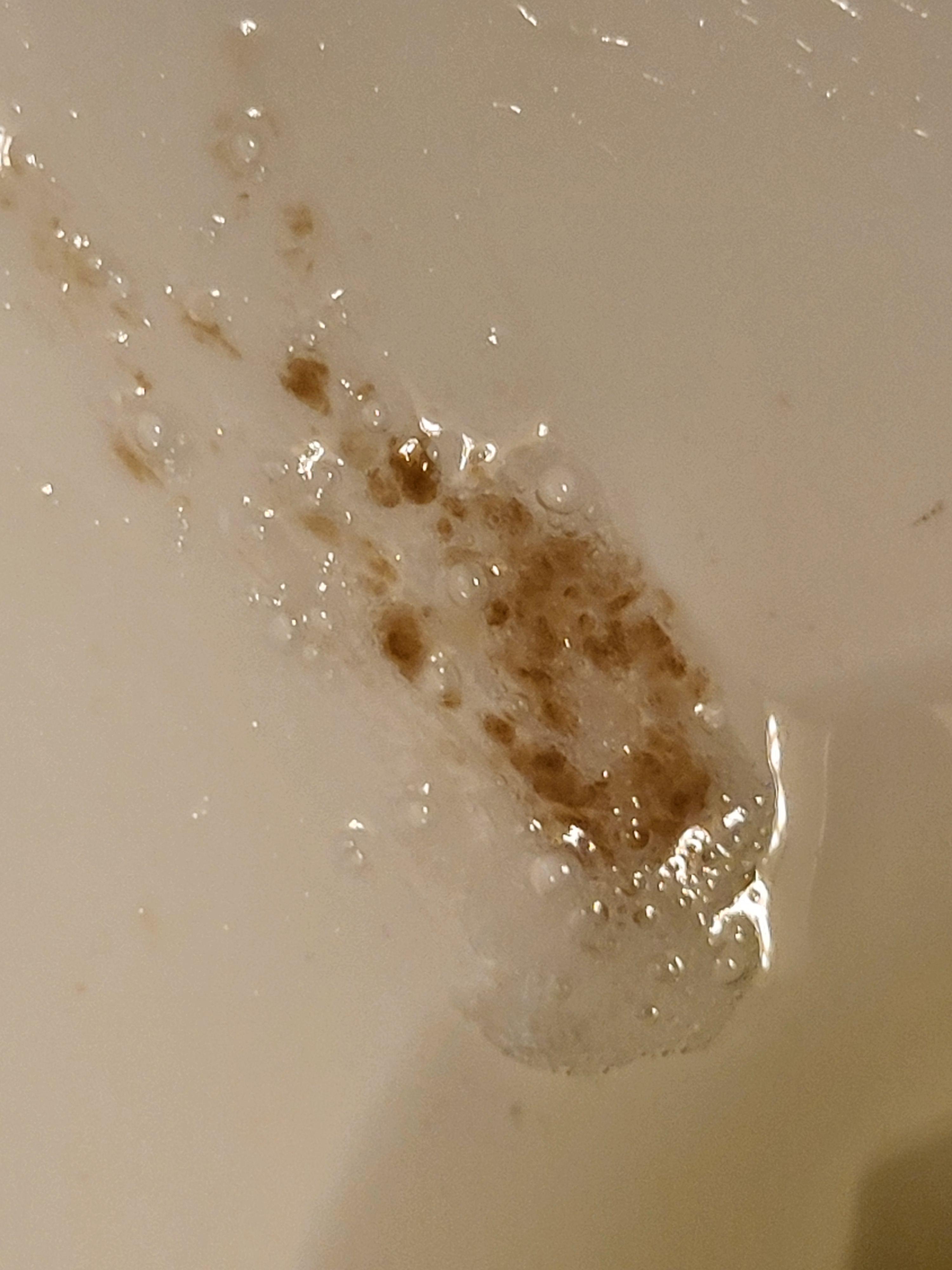 Phlegm Brown Specks
