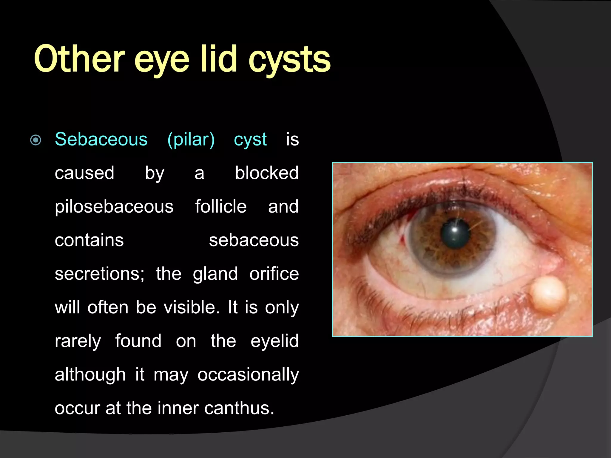 Phoebe Bridges Nudes