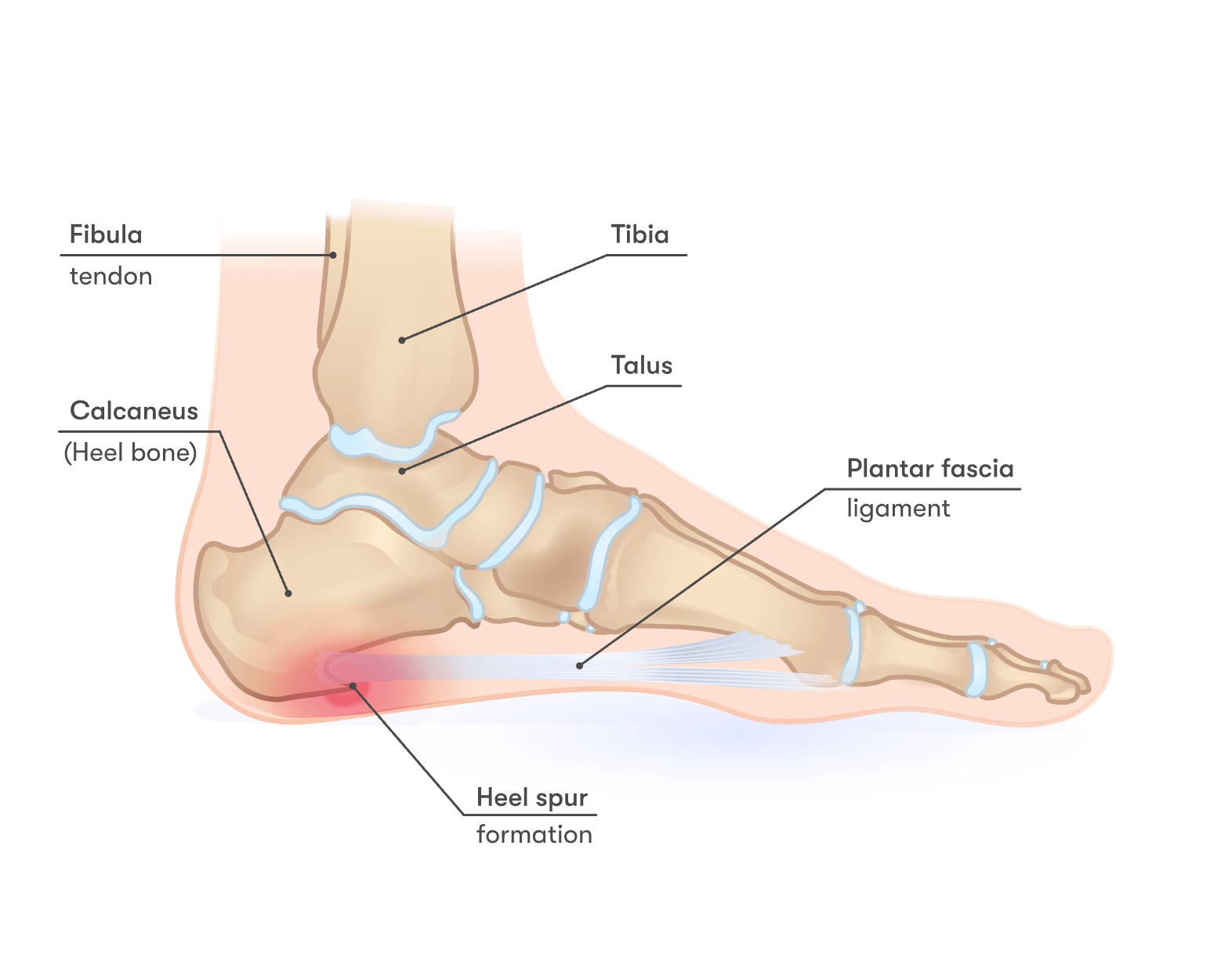 Pictures Of Bone Spurs