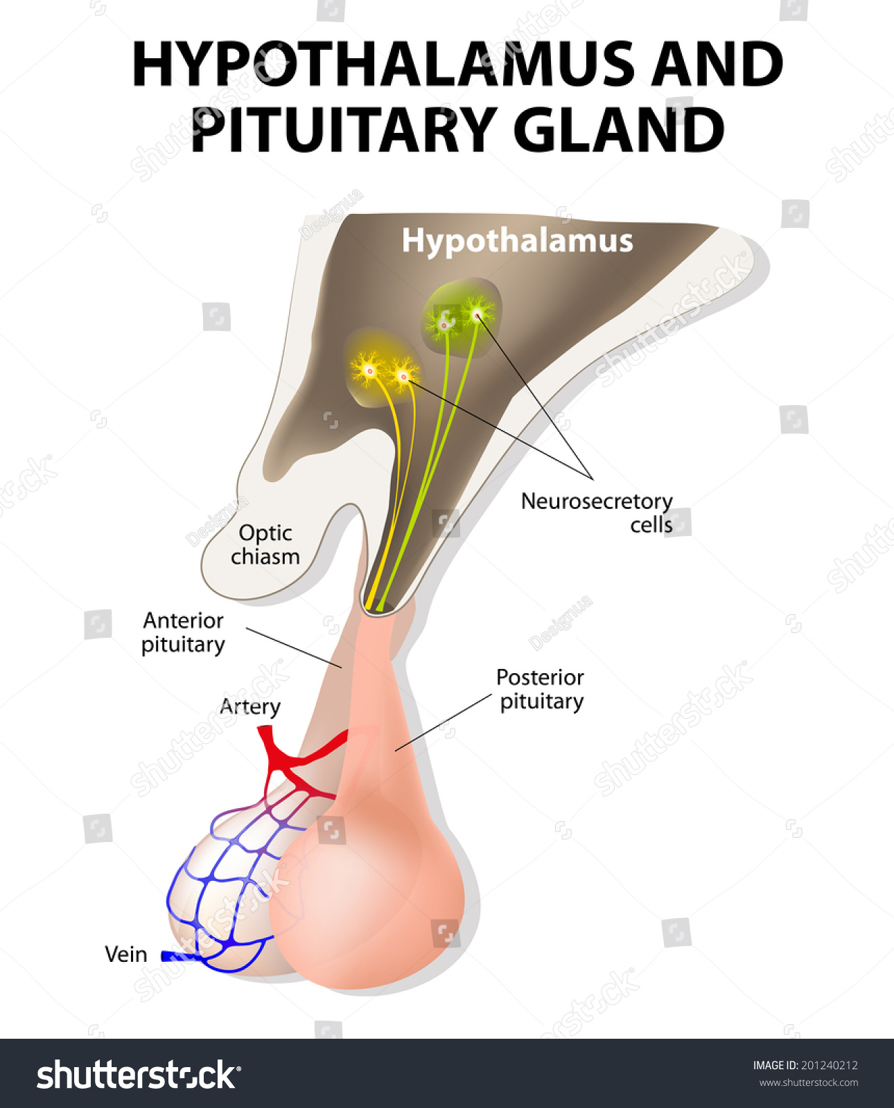 Pituitary With Infundibular Stalk