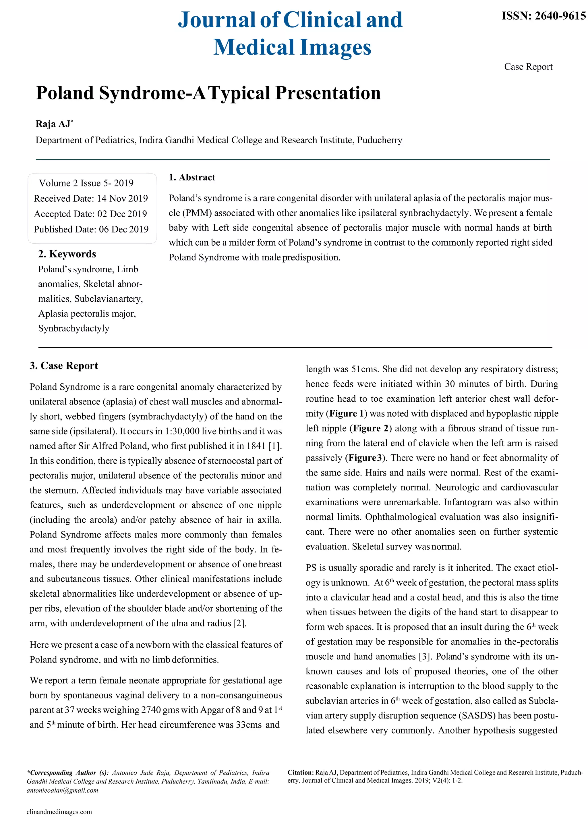 Poland Syndrome Pec Implant
