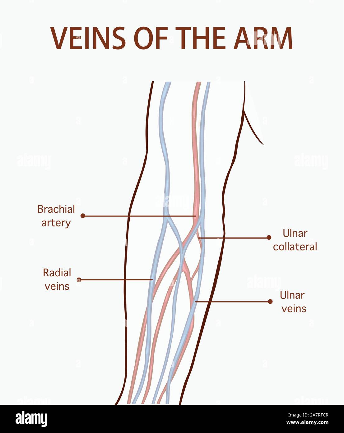 Pop Blood Vessel In Arm