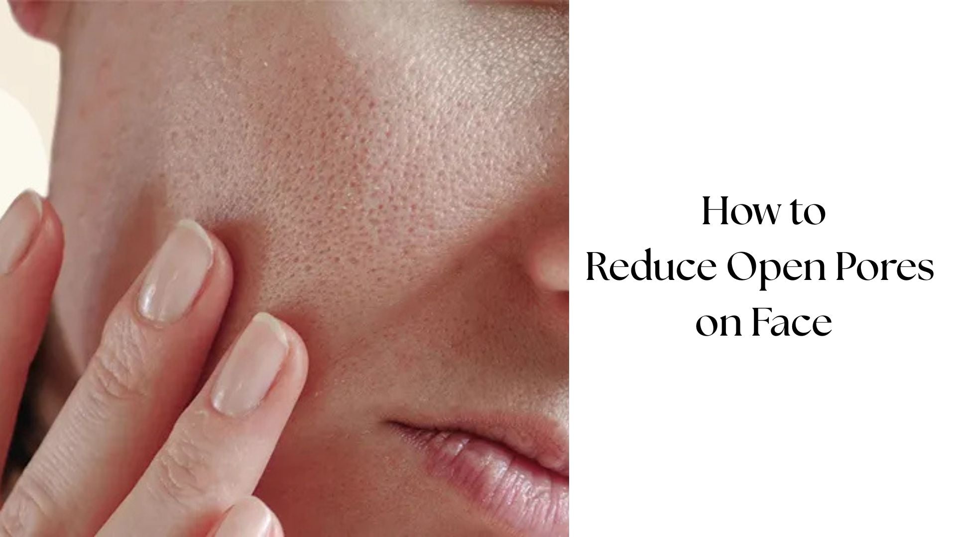 Pores On Face