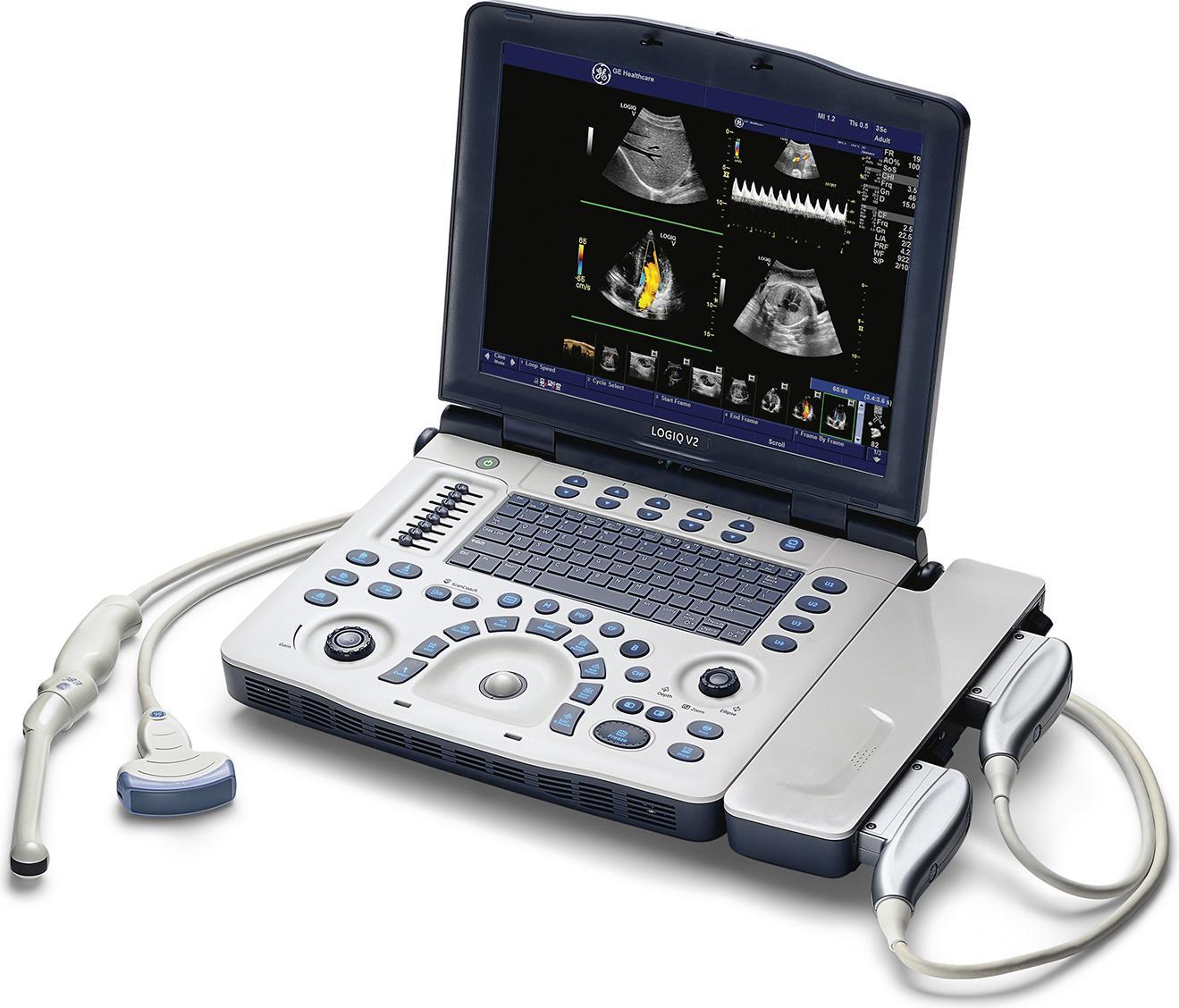 Portable Ultrasound Machine