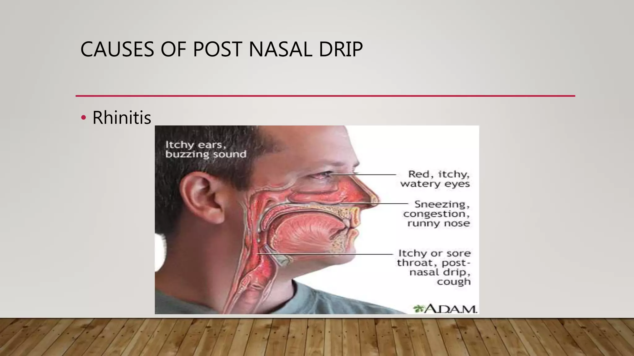 Post Nasal Drip Nausea
