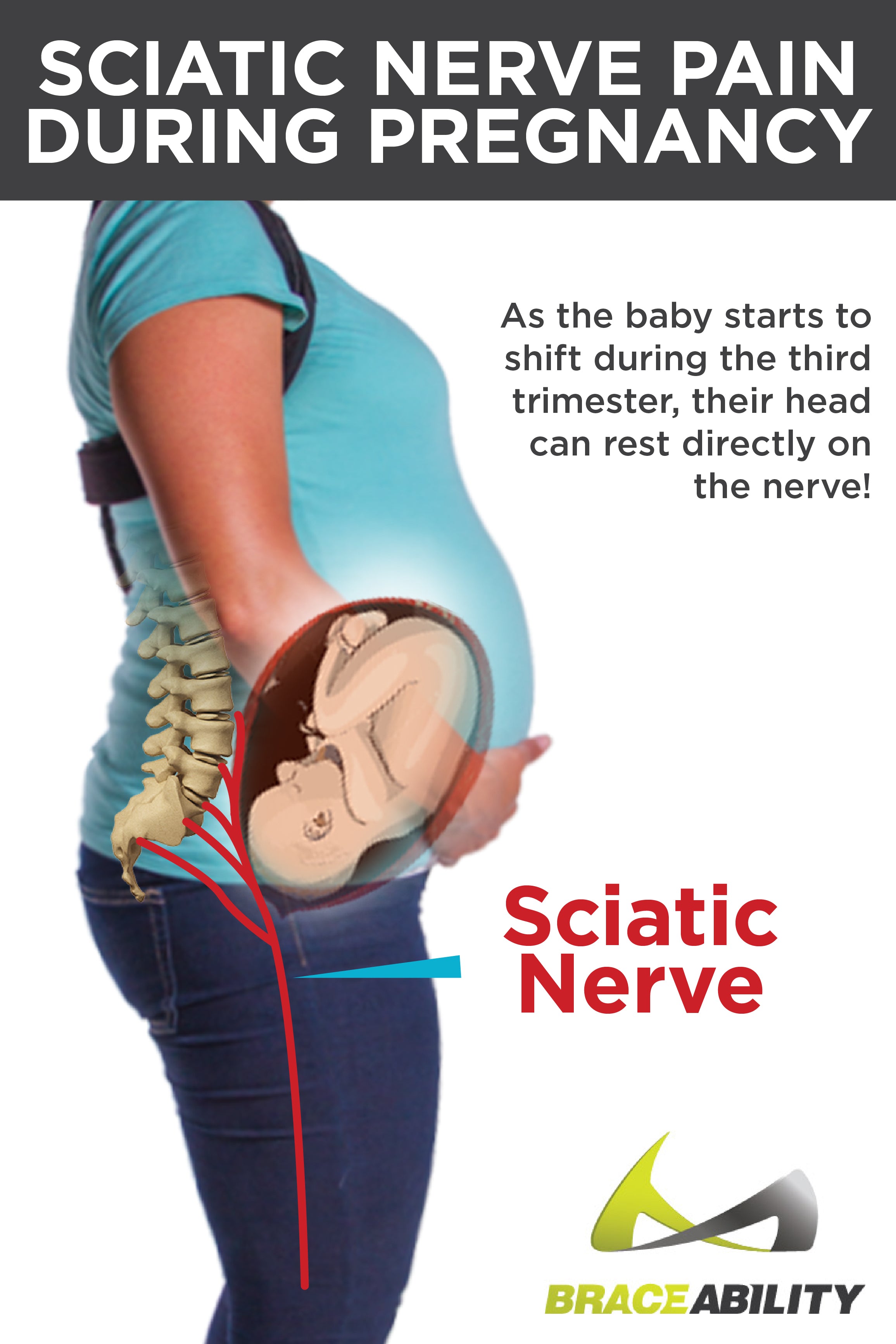 Pregnancy And Sciatica Nerve