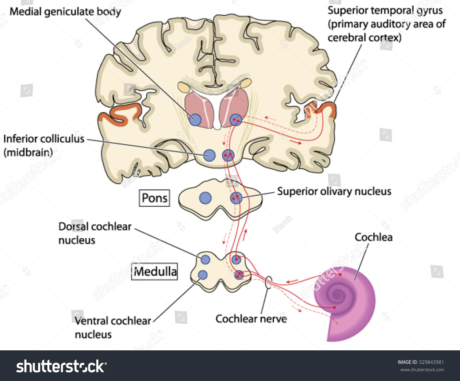 Primary Auditory Area