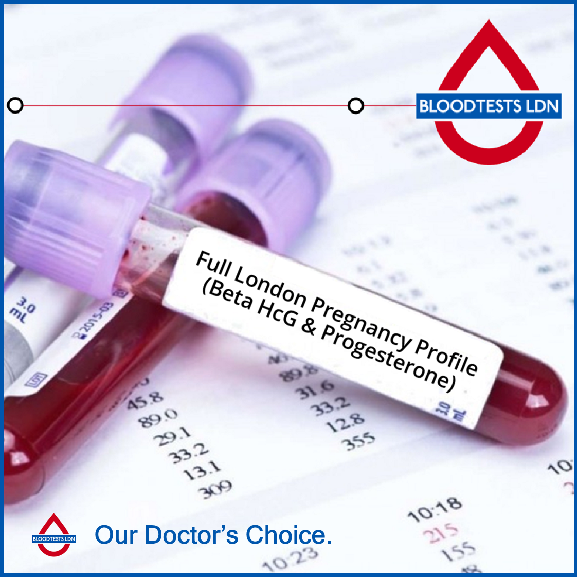 Progesterone Blood Test