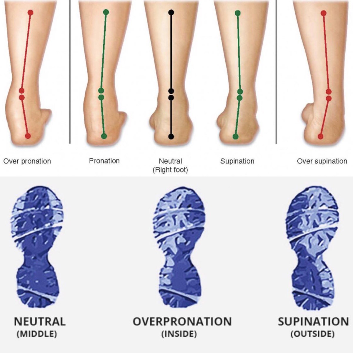 Pronation And Overpronation