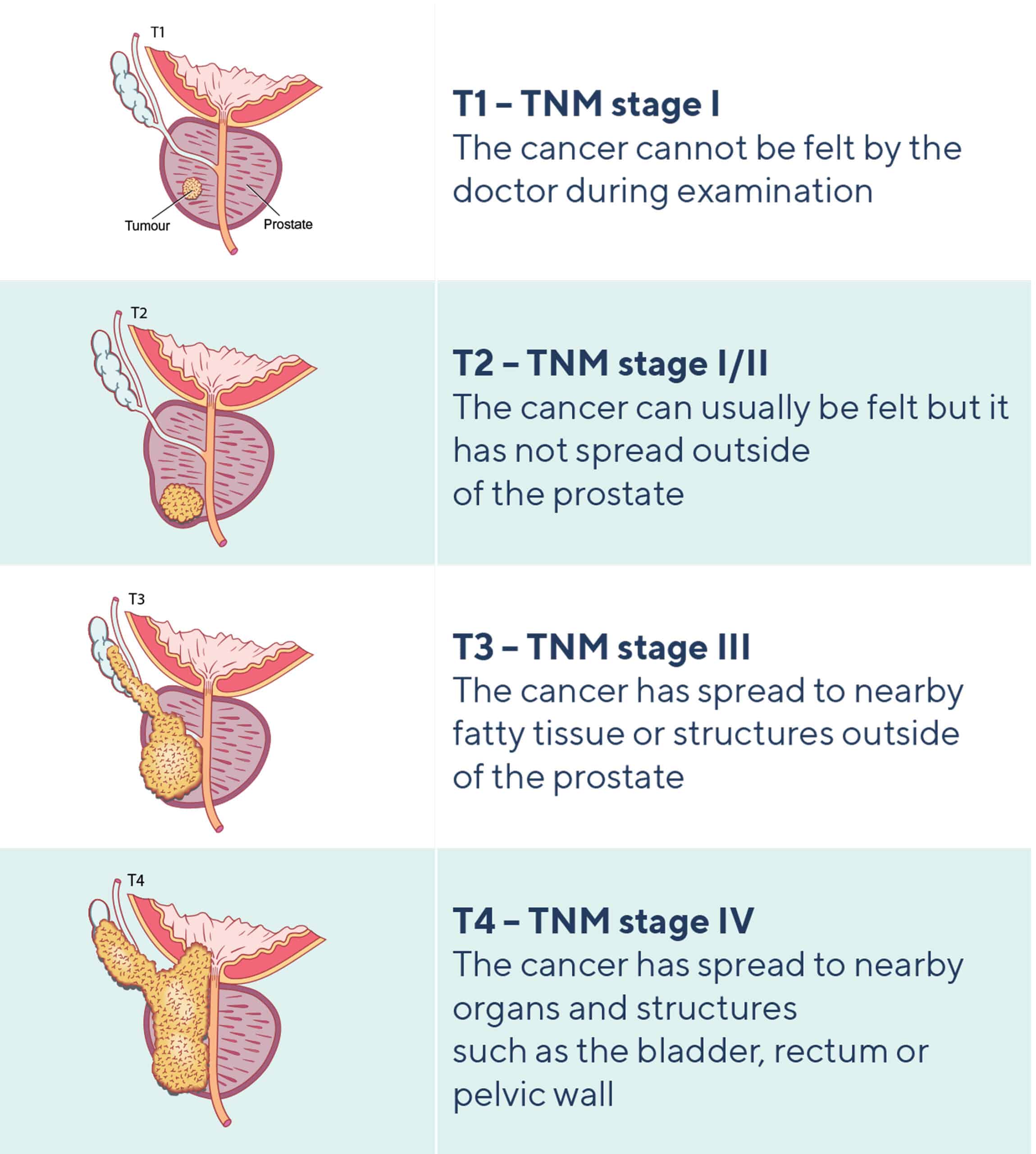 Prostate Cancer Recovery Rate