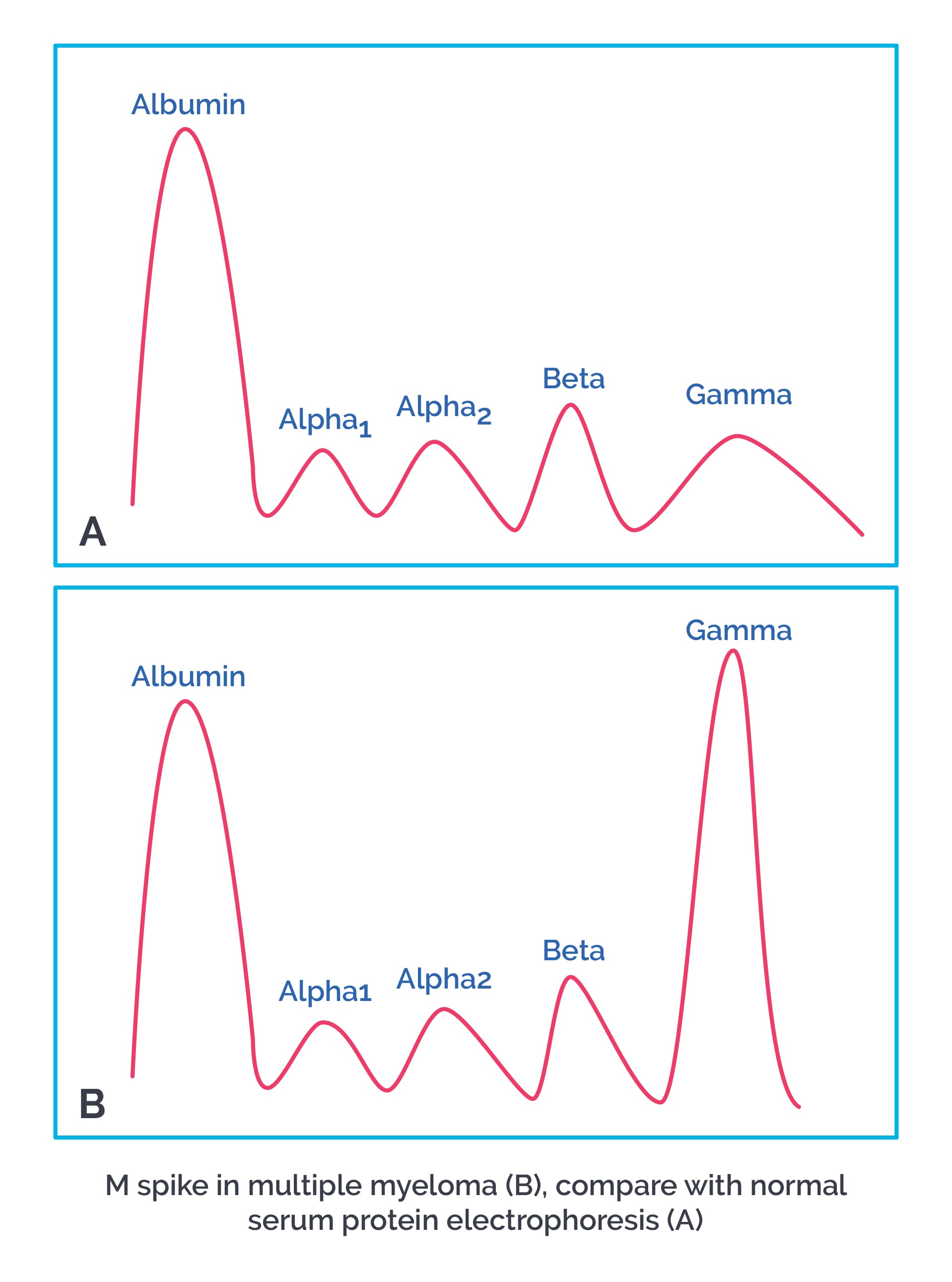 Protein Electrophoresis Mspike