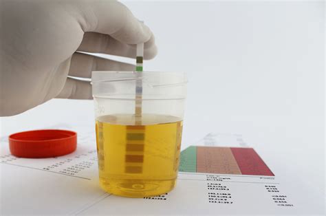 Protein In Pee