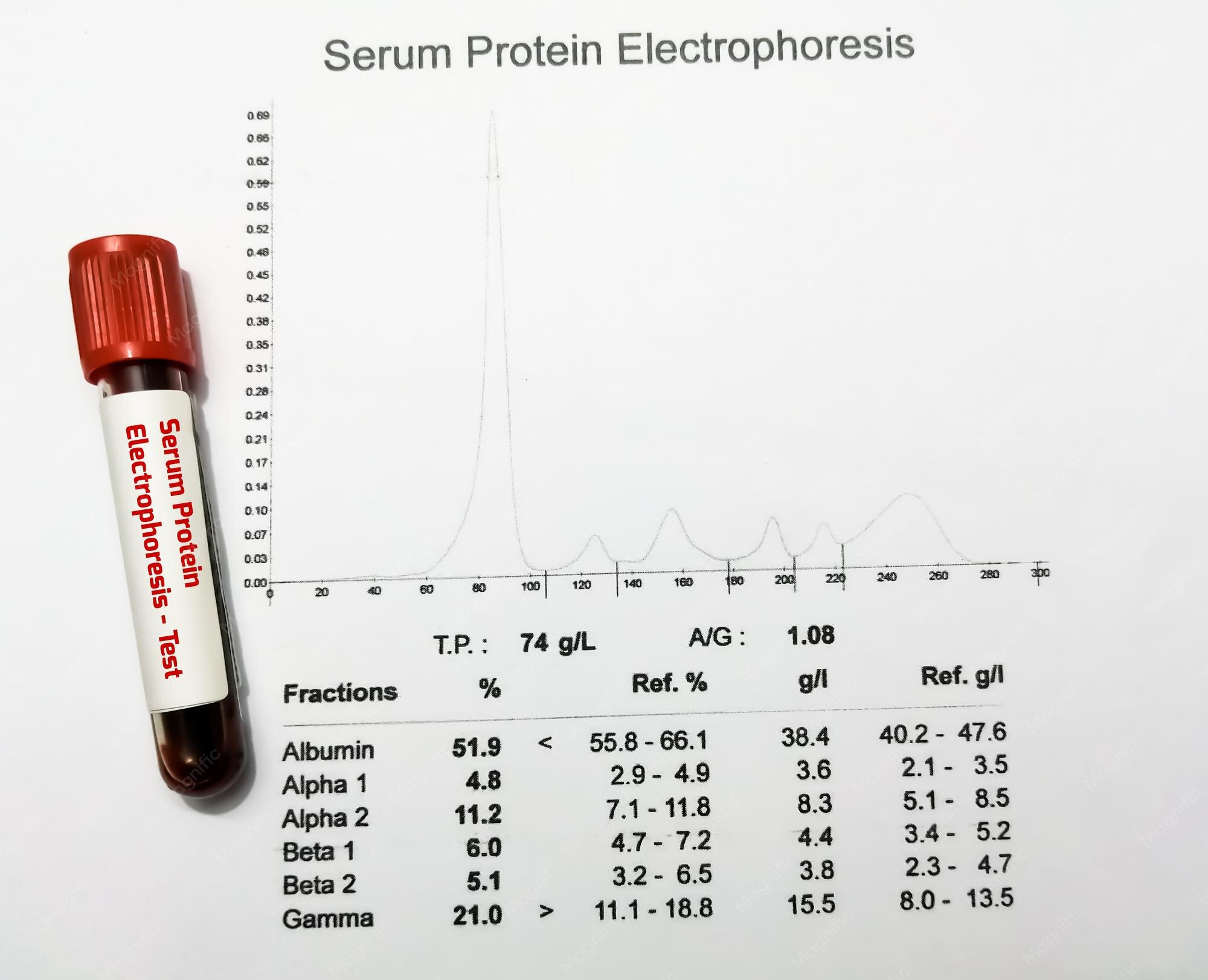 Protein Value In Blood