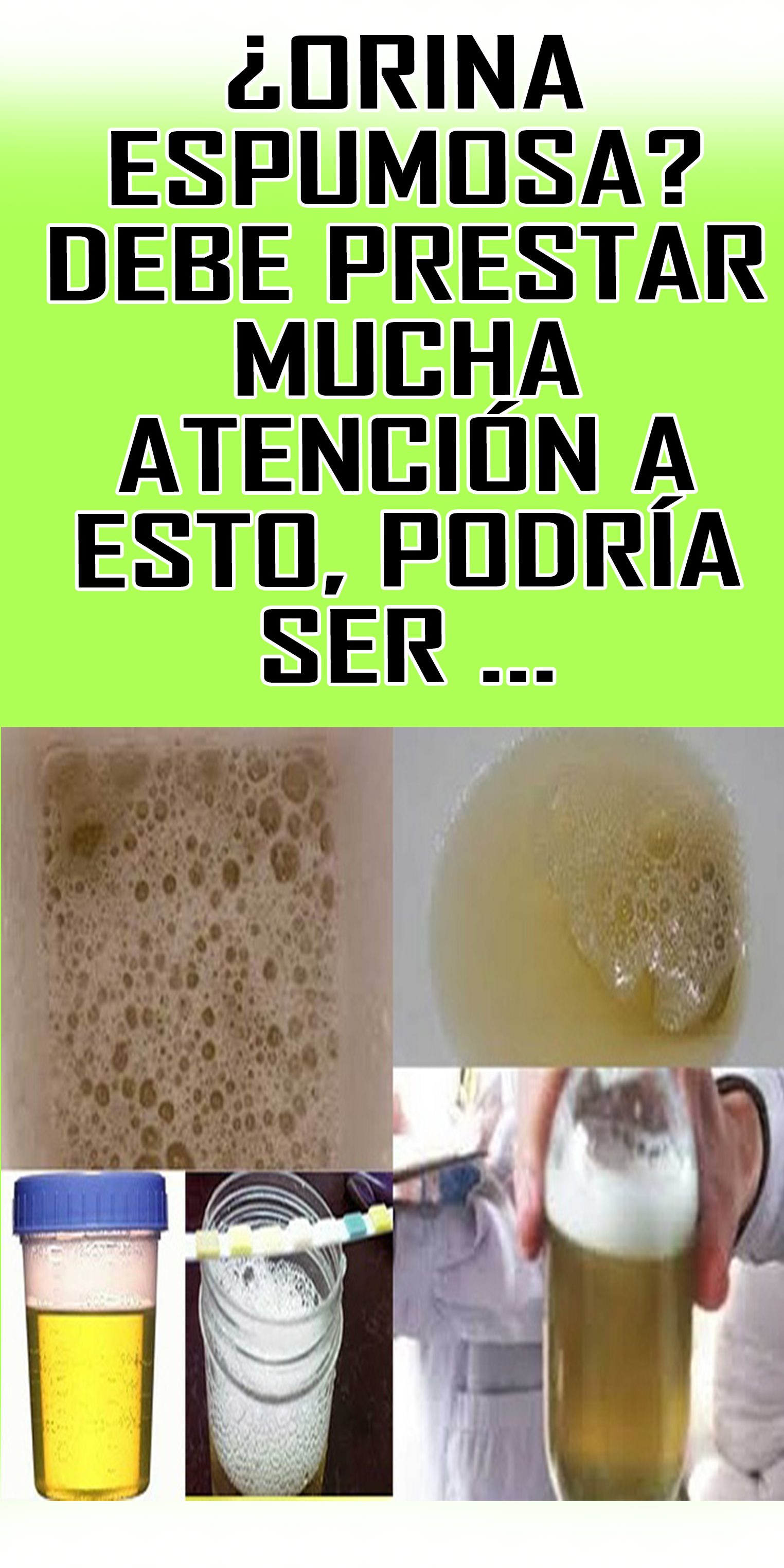 Proteina En La Orina