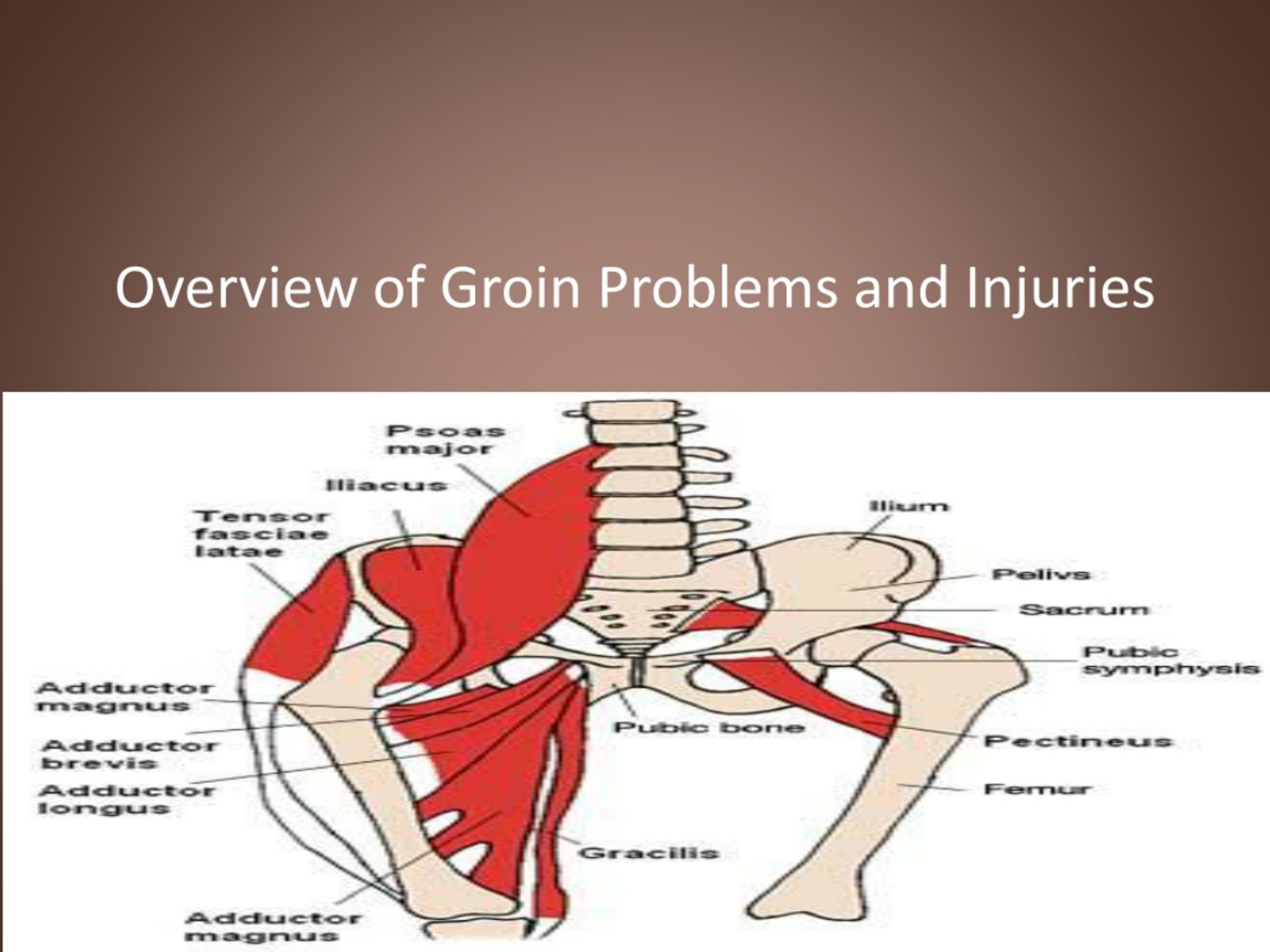 Pulled Groin Muscle Female Symptoms