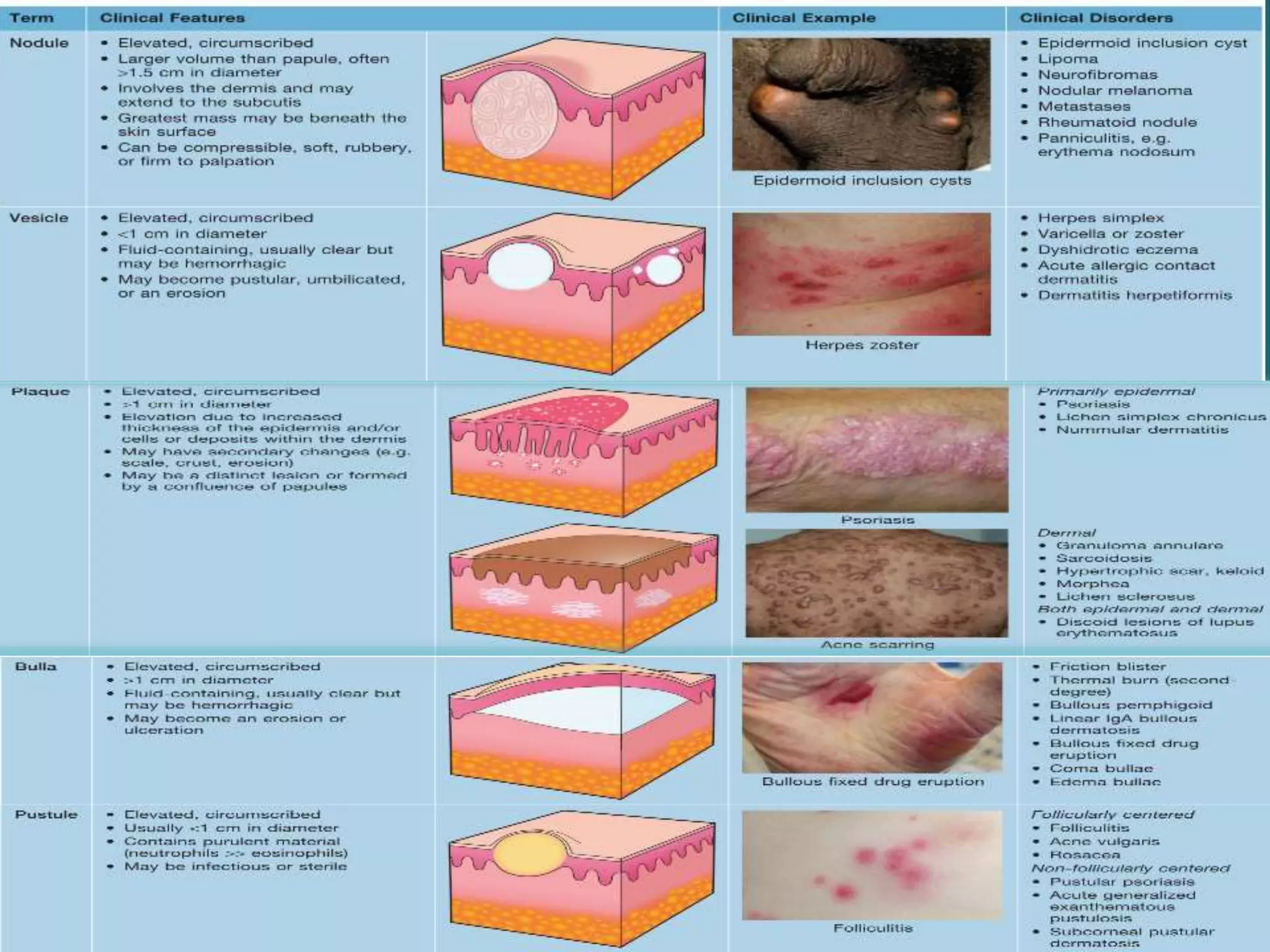 Pustules On Vag