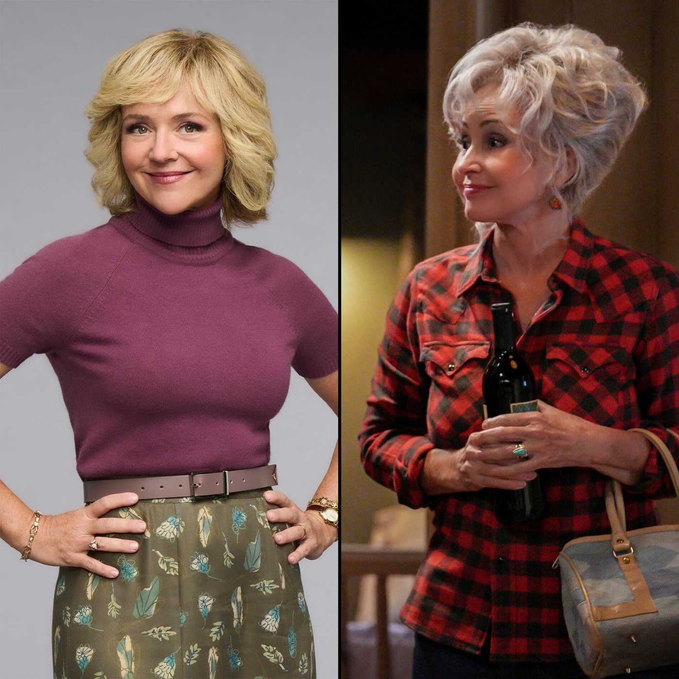 Rachel Bay Jones Face Surgery