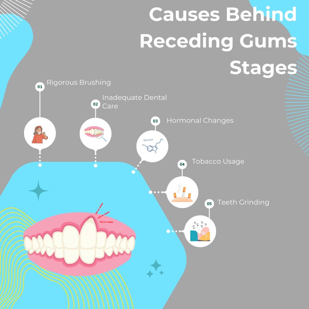Receding Gums Stages