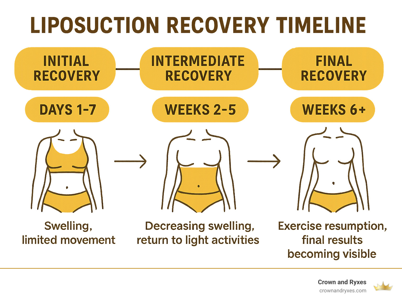 Recovery After Liposculpture