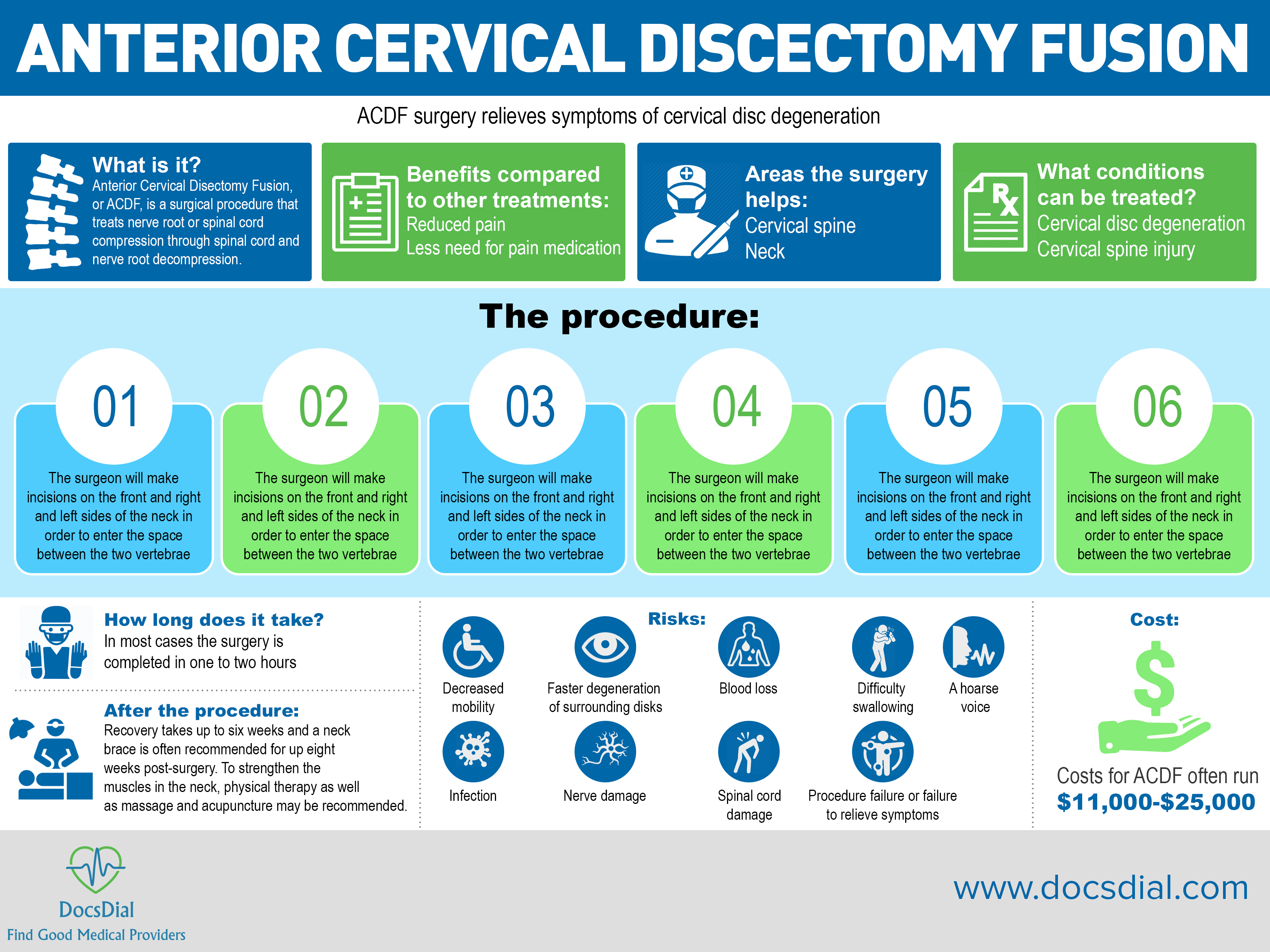 Recovery Time For Discectomy
