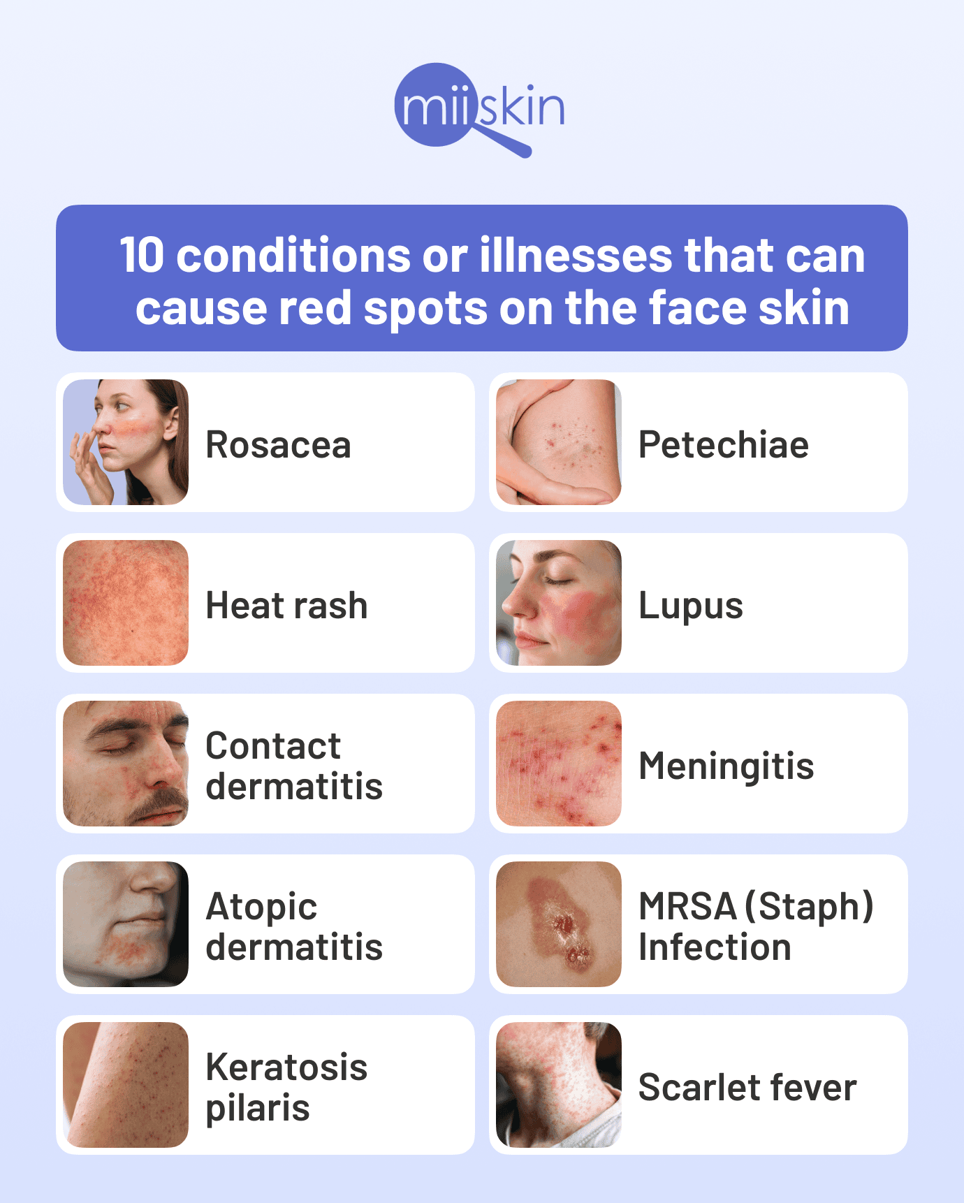 Red Face Causes