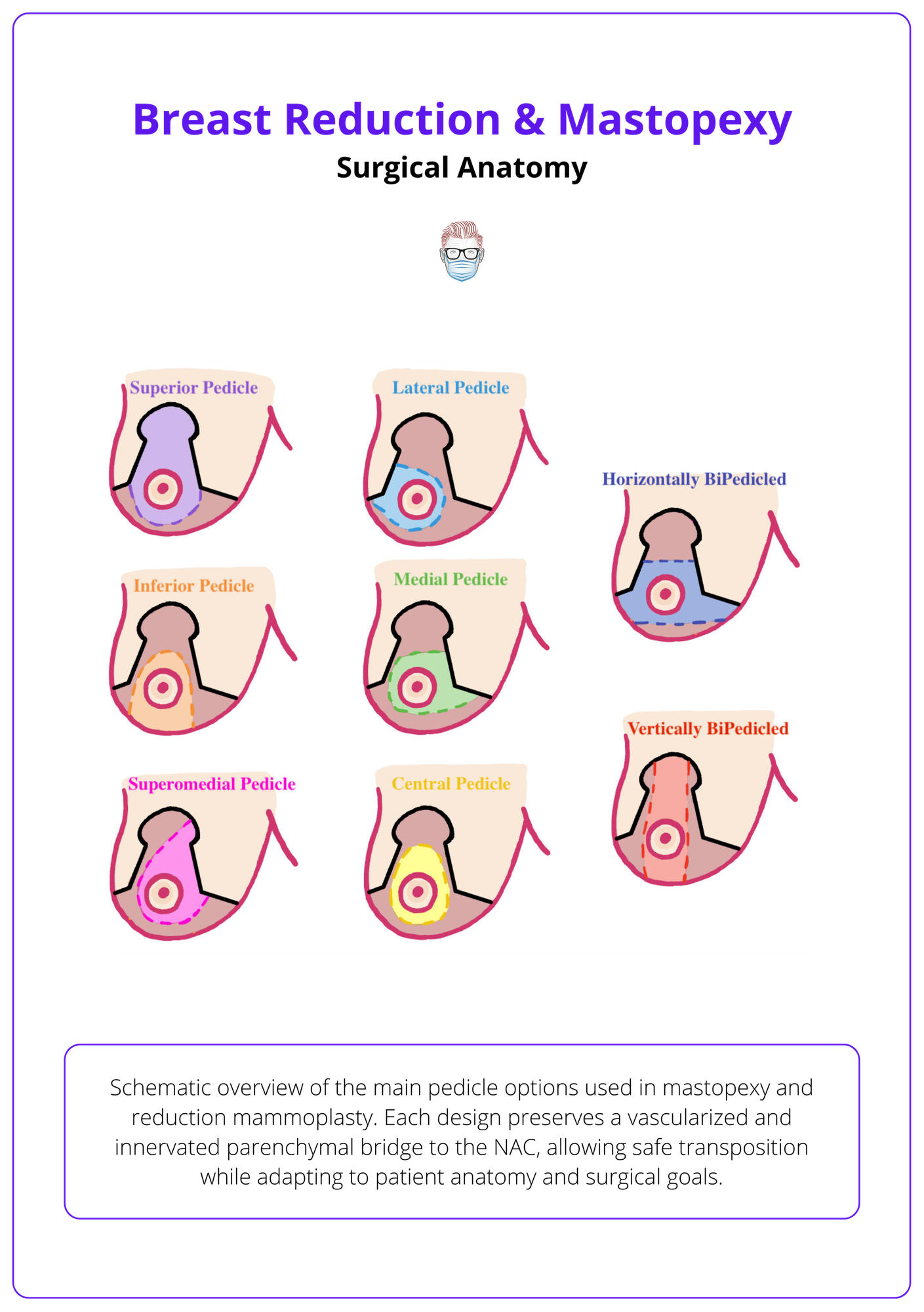 Reduction Mammoplasty Recovery Time