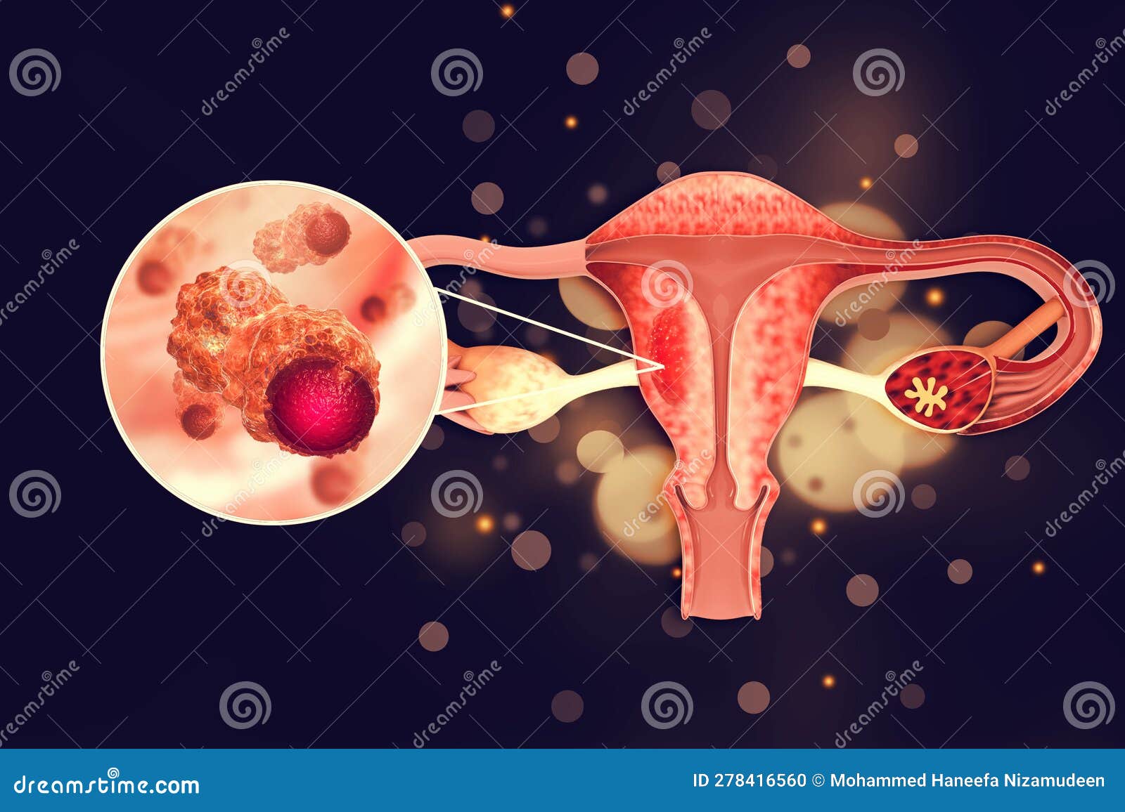 Reproductive Tract Diseases