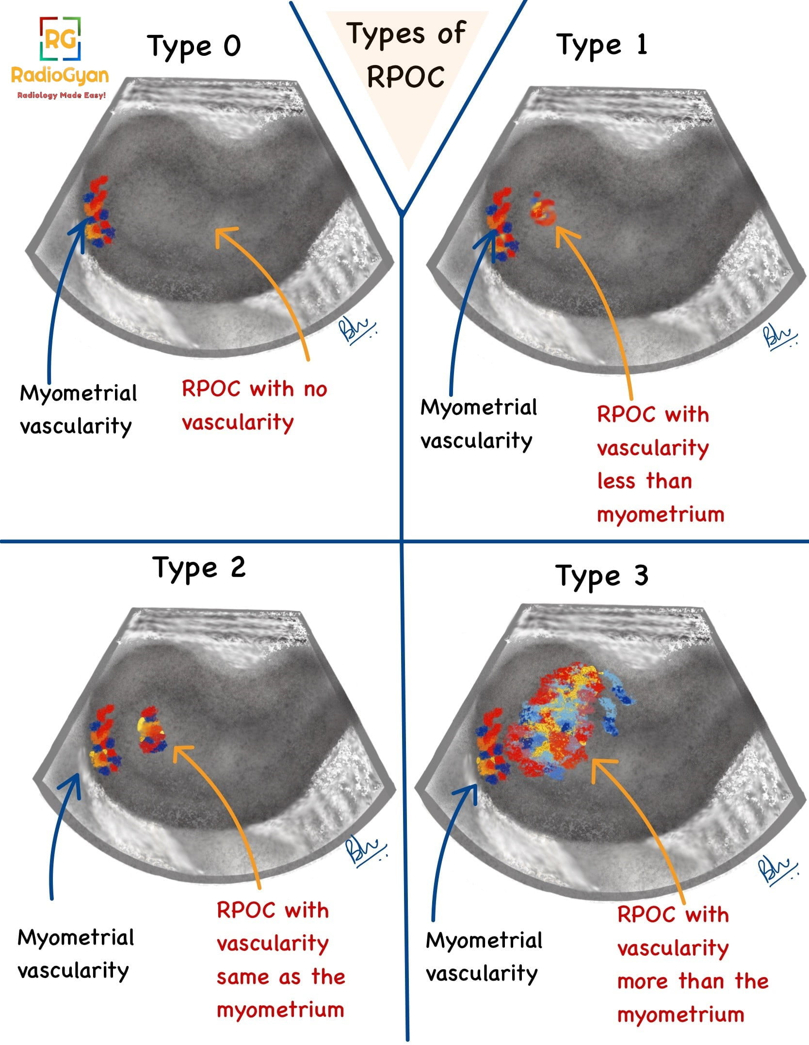 Retained Products Conception