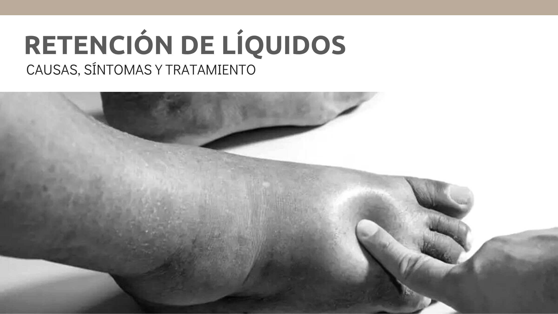 Retencion De Liquidos