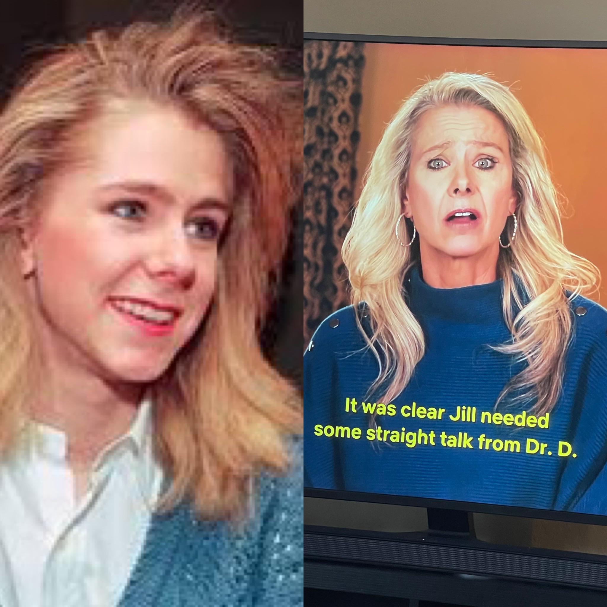 Robin Zasio Face Surgery