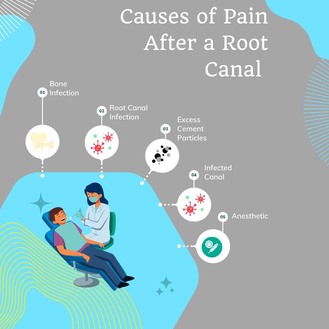 Root Canal And Pain After