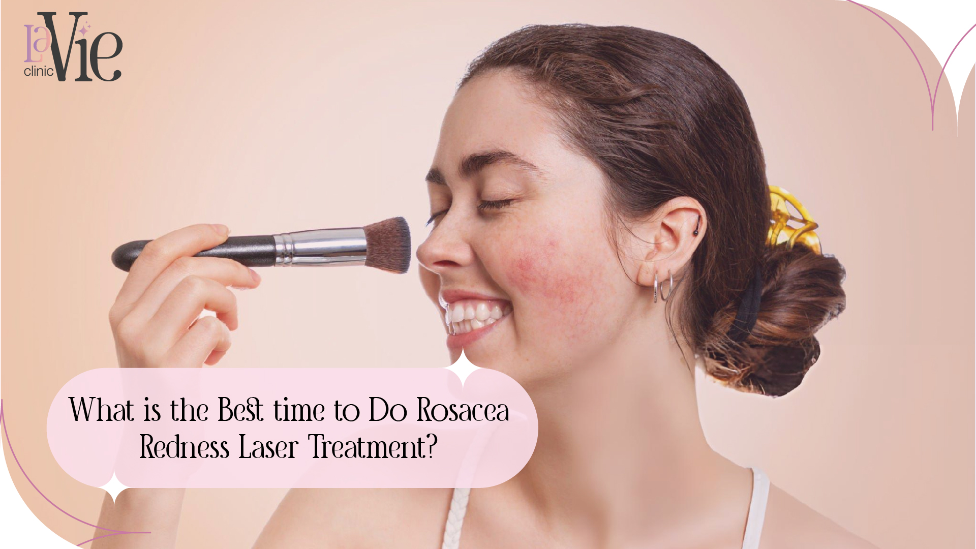 Rosacea Redness Laser Treatment