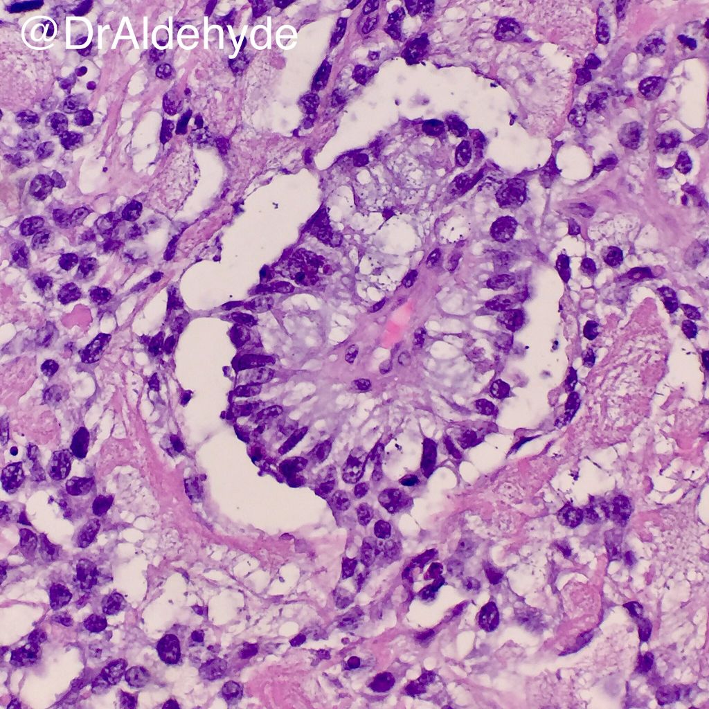 Schiller Duval Bodies