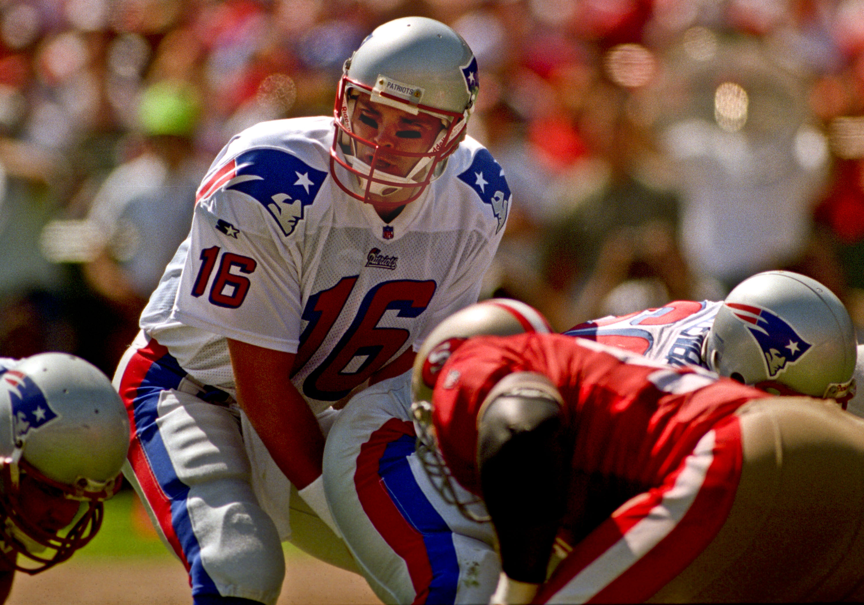 Scott Zolak Face Surgery