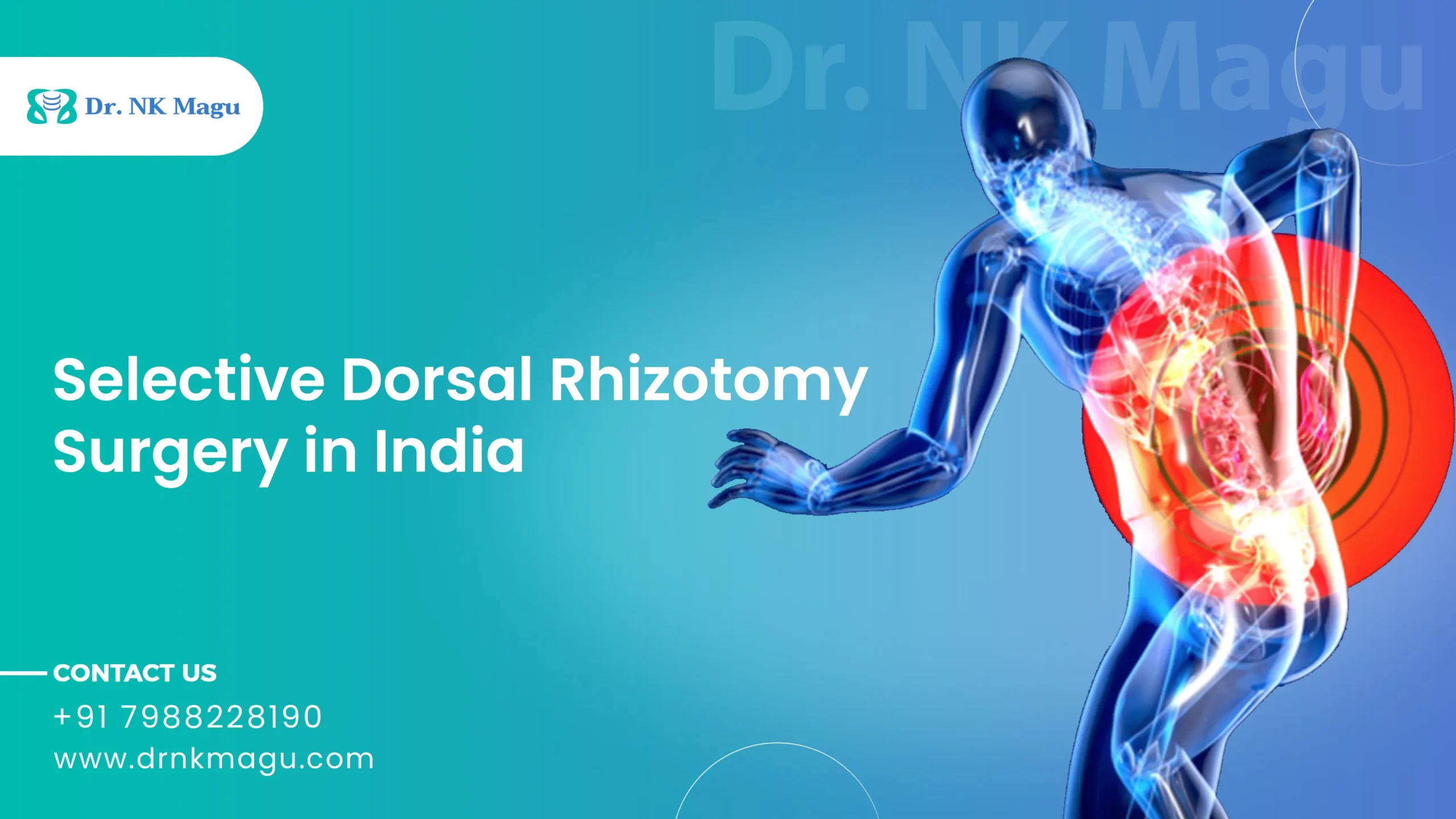 Selective Dorsal Rhizotomy