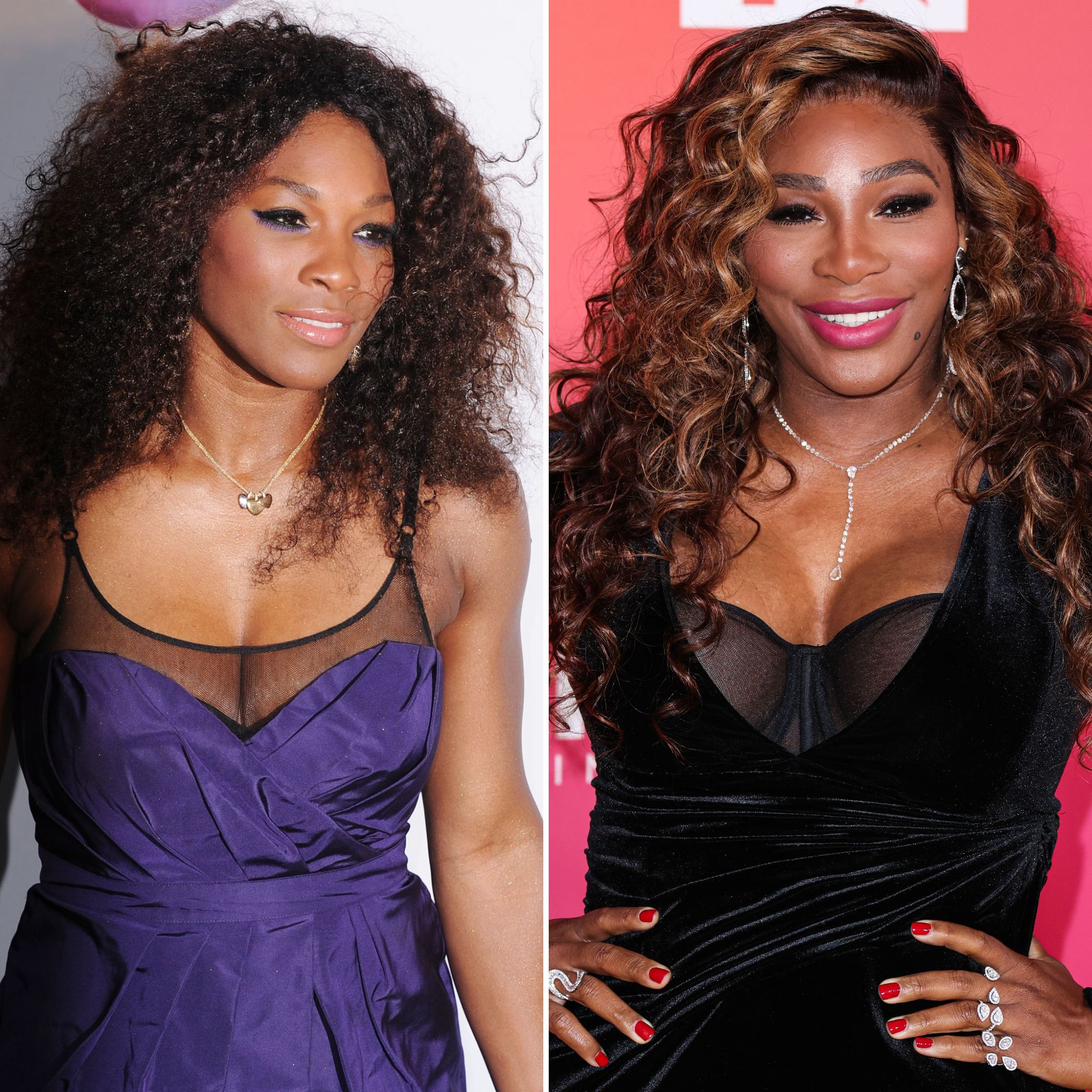 Serena Williams Surgery Face