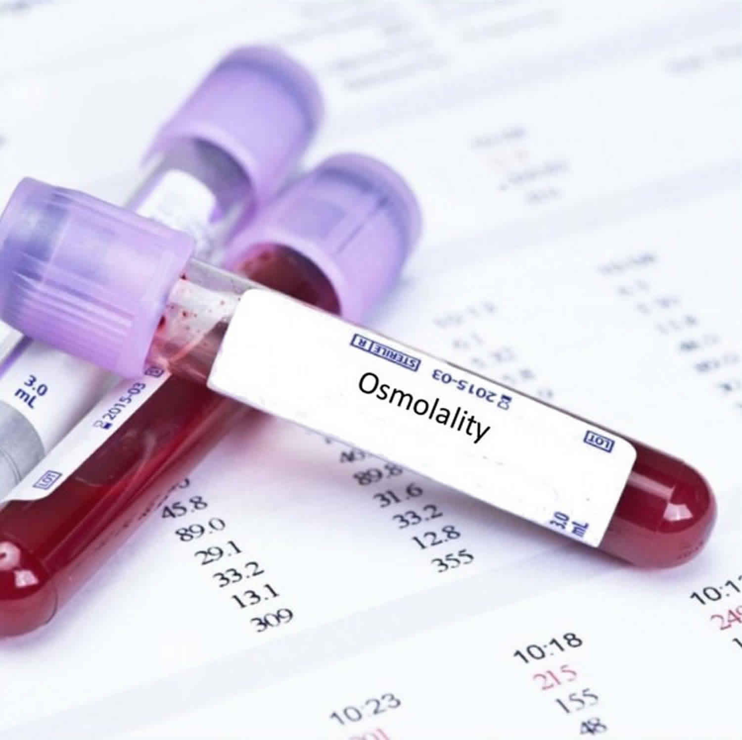 Serum Osmolality Urine