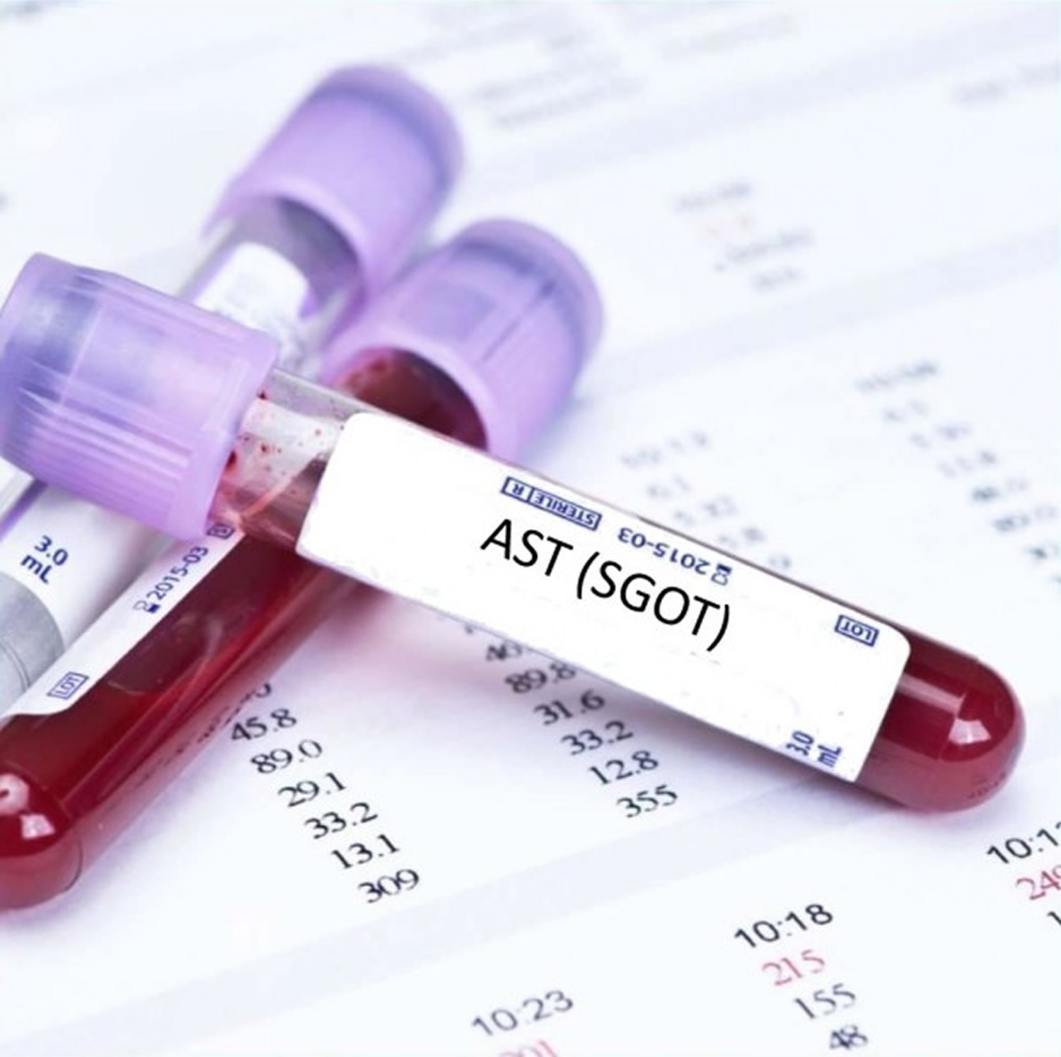 Sgot Ast Blood Test Low