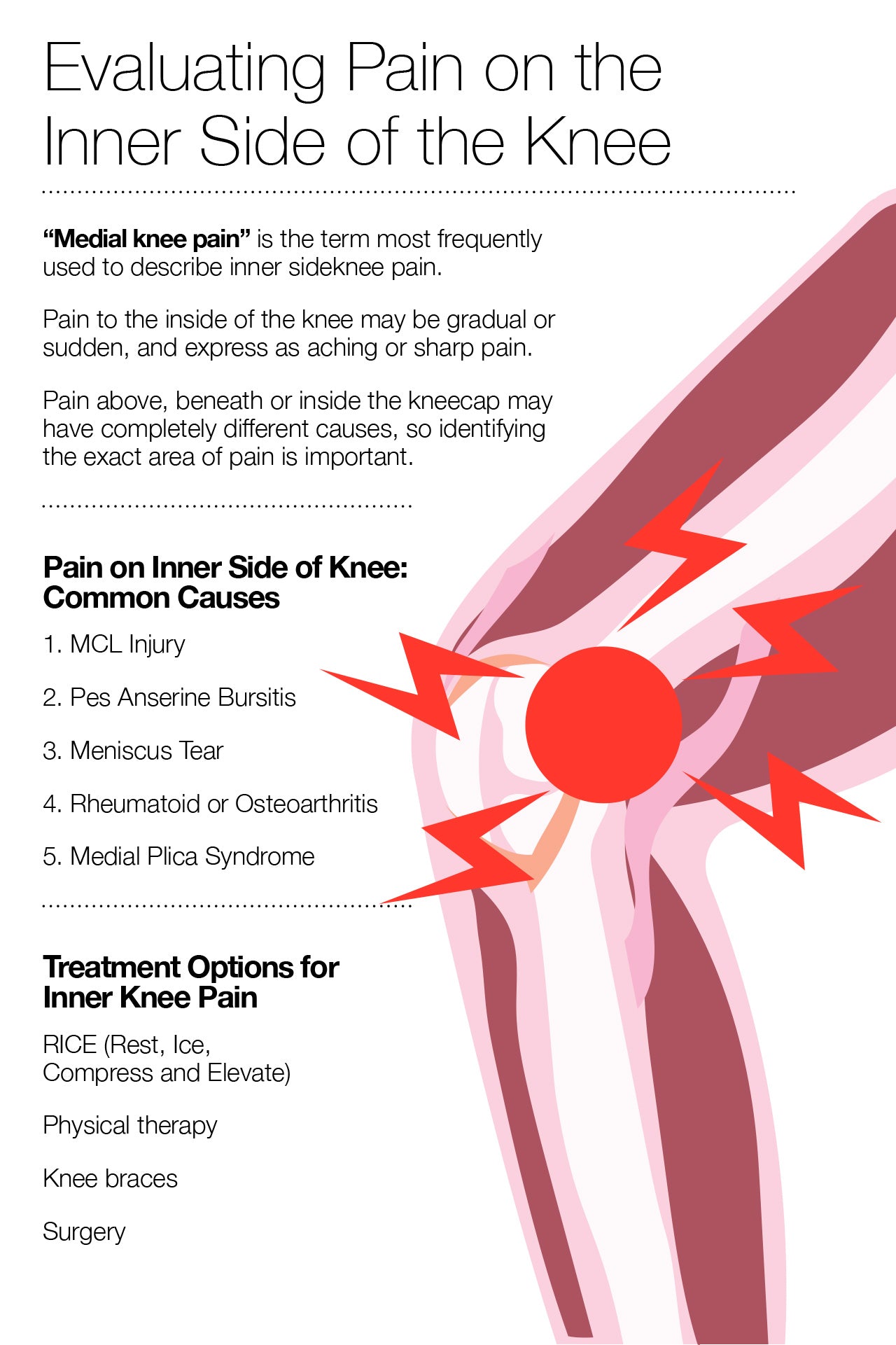 Sharp Knee Pain