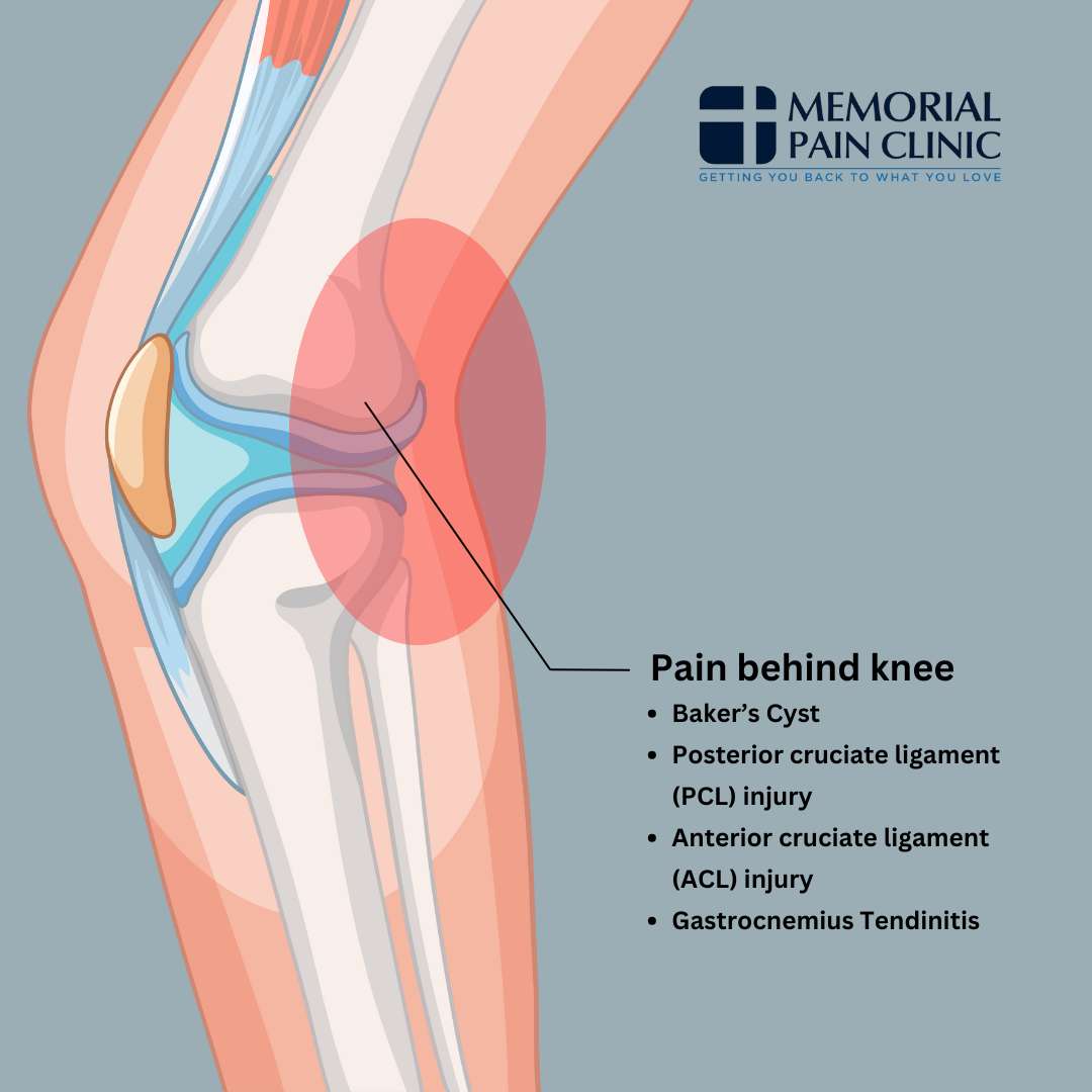Sharp Pain Behind Knee