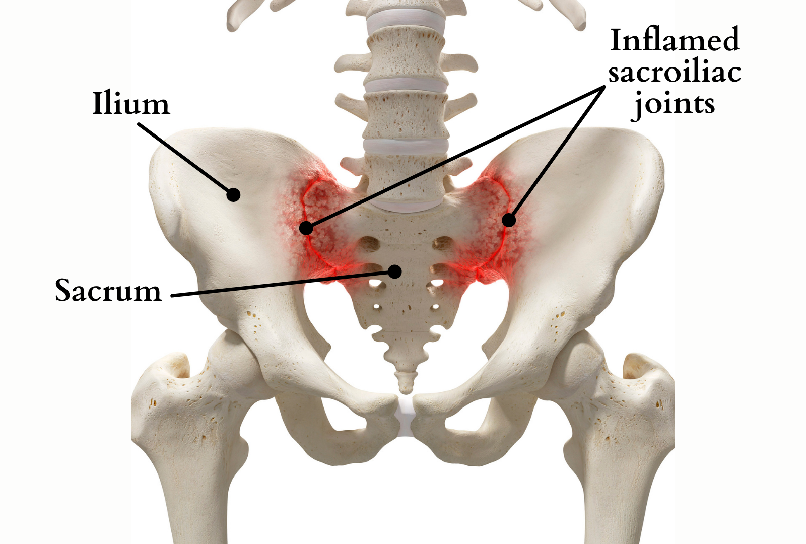 Si Joint Pain Symptoms
