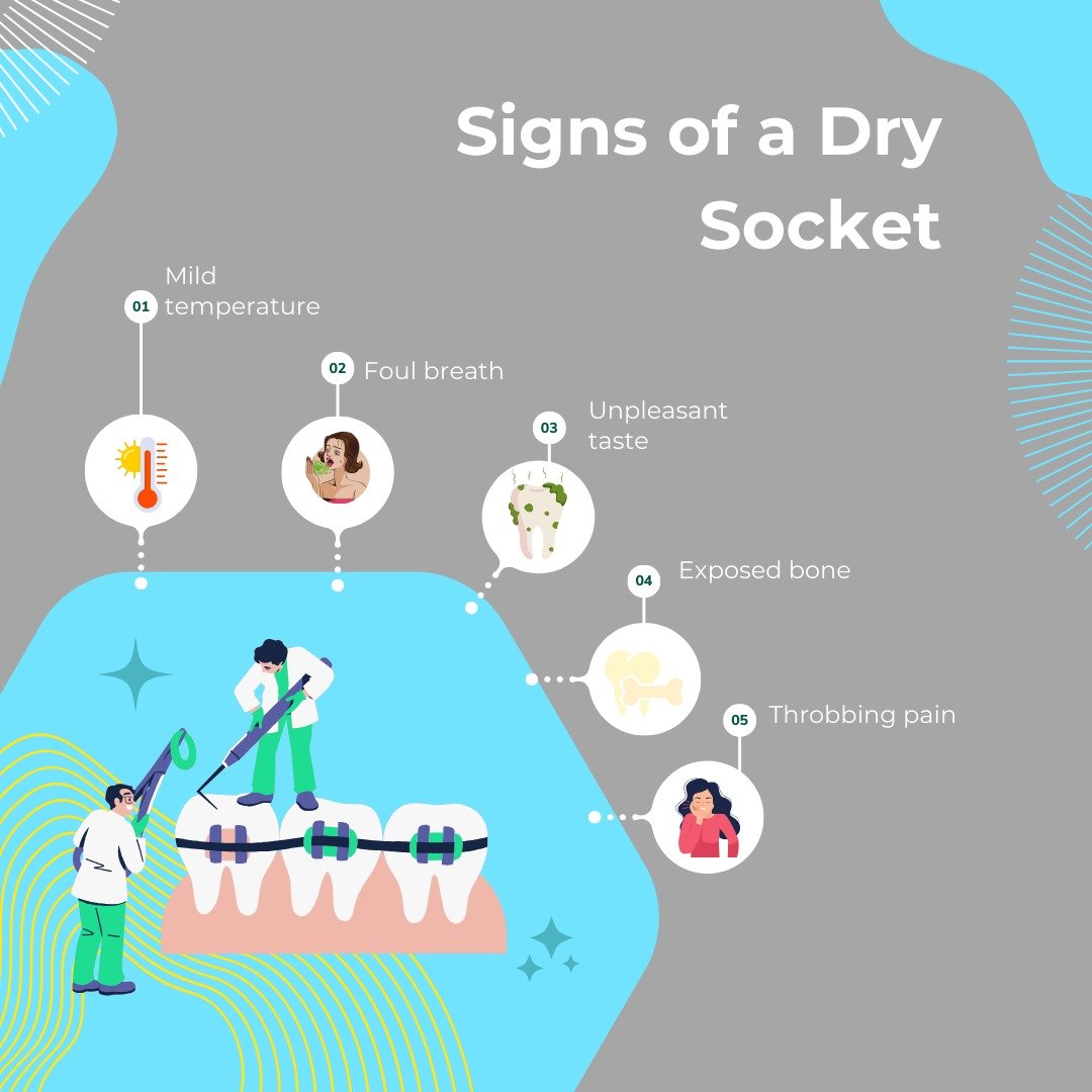 Signs Of A Dry Socket