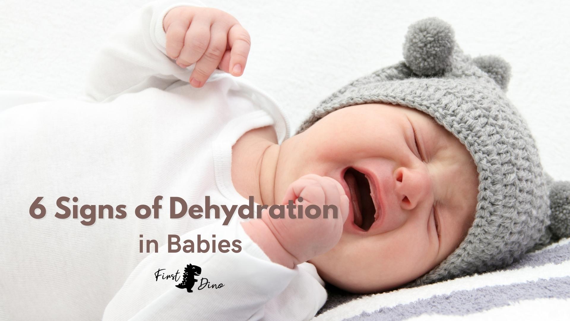 Signs Of Dehydrated Newborn