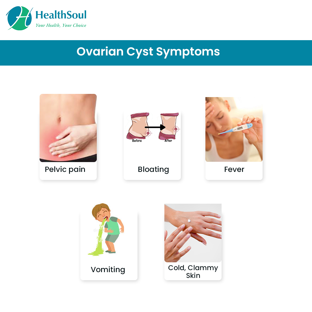 Signs Of Ruptured Ovarian Cyst
