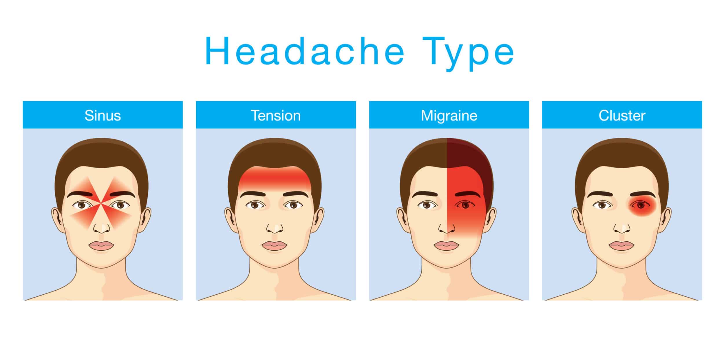 Sinus Headache Characteristics