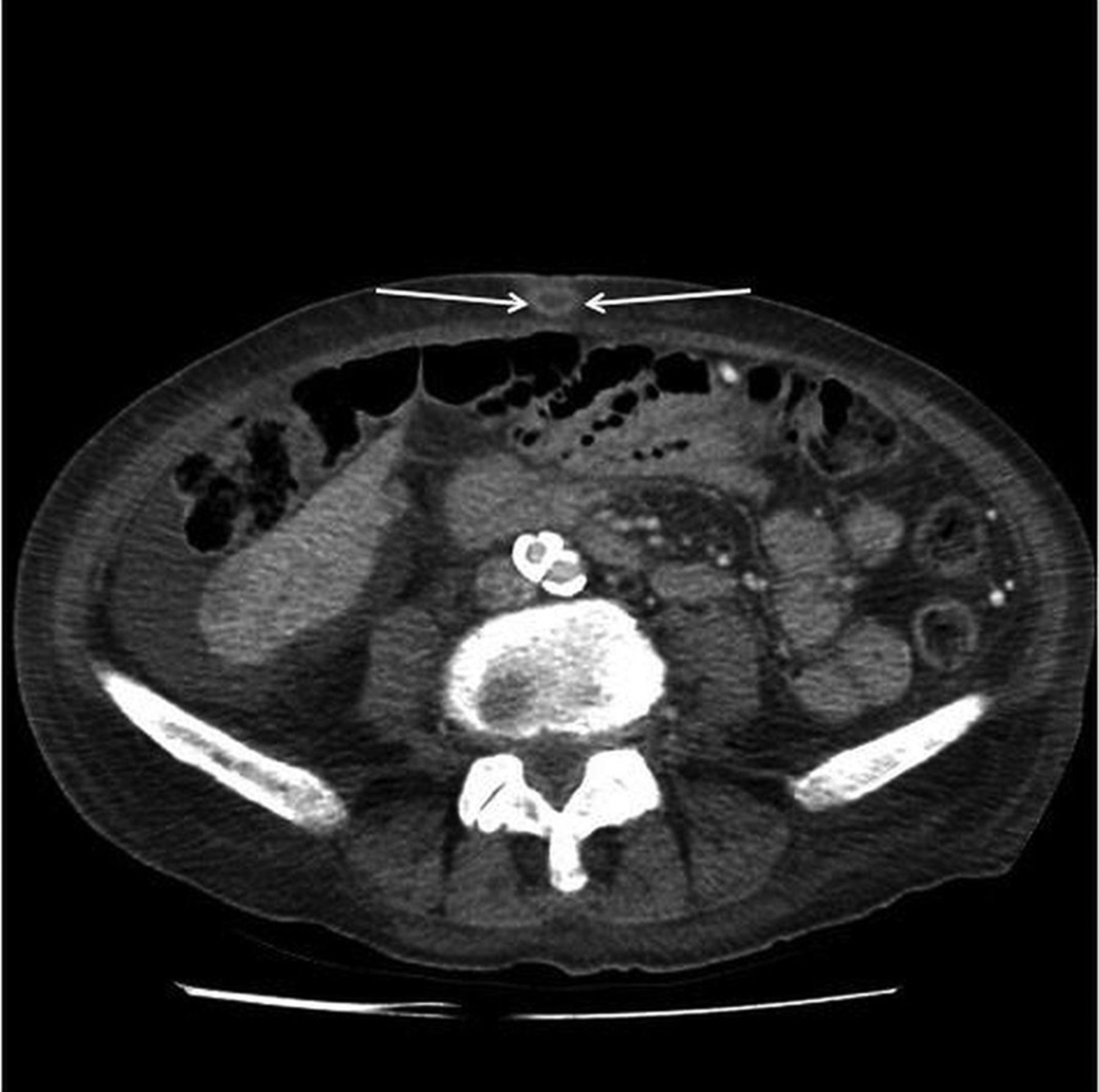 Sister Mary Joseph Sign