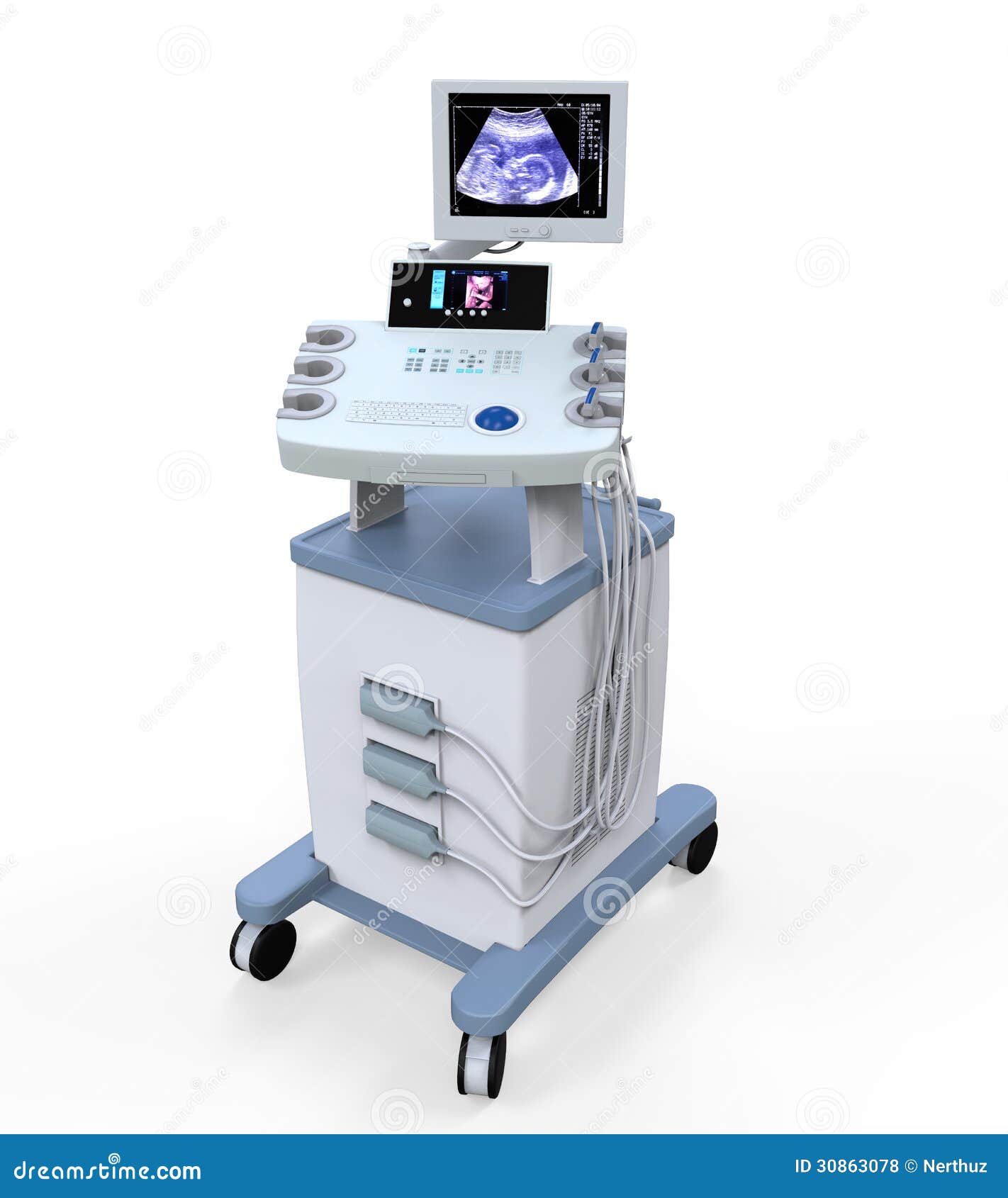 Sonography Machine