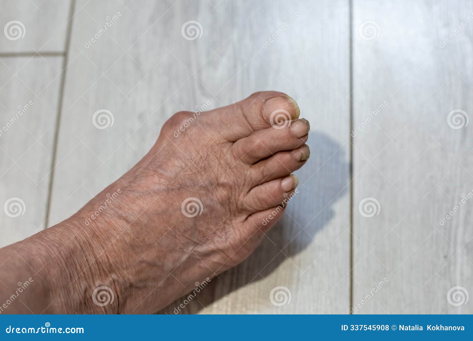 Sore Big Toe Joint