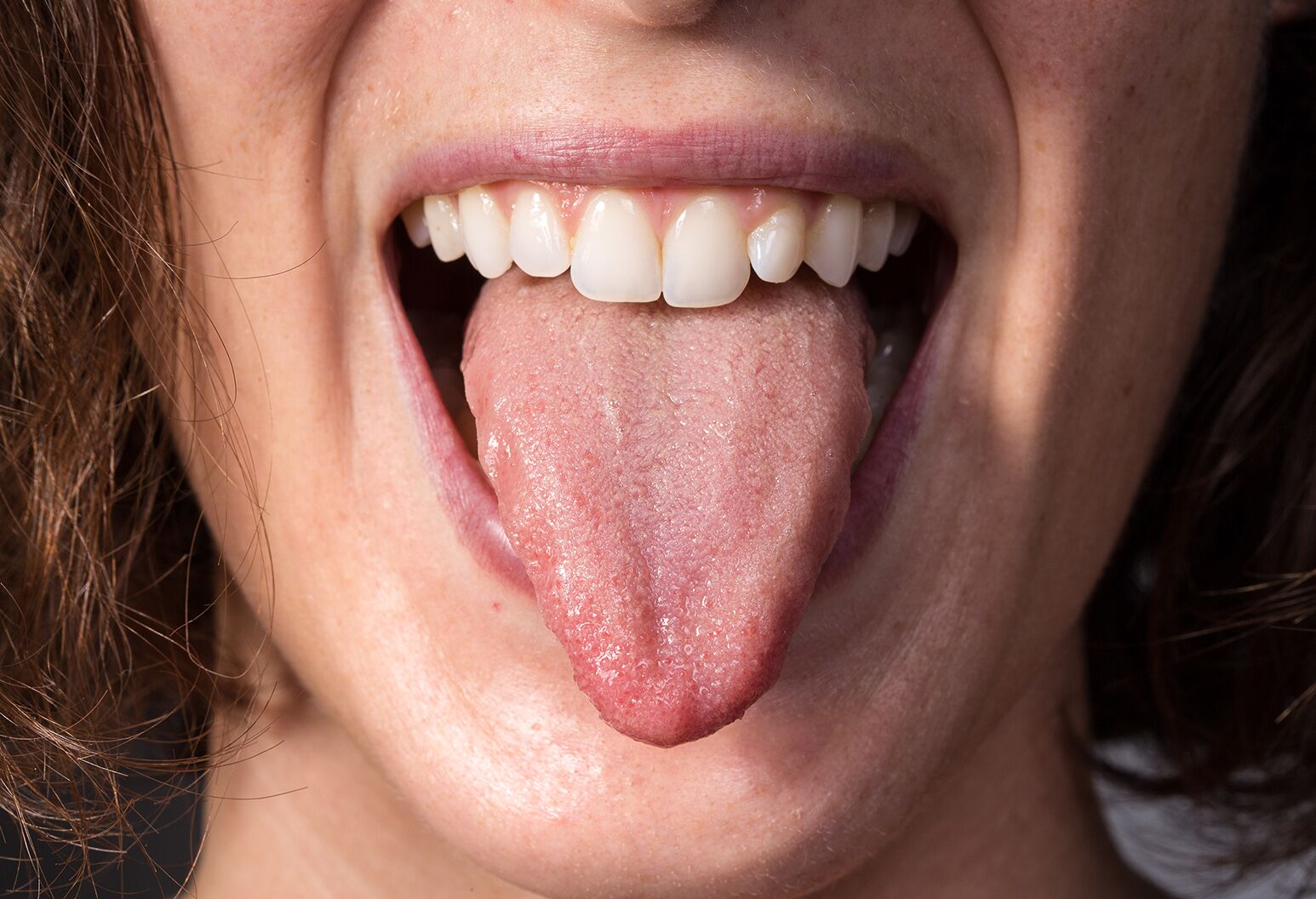 Sore Side Tongue