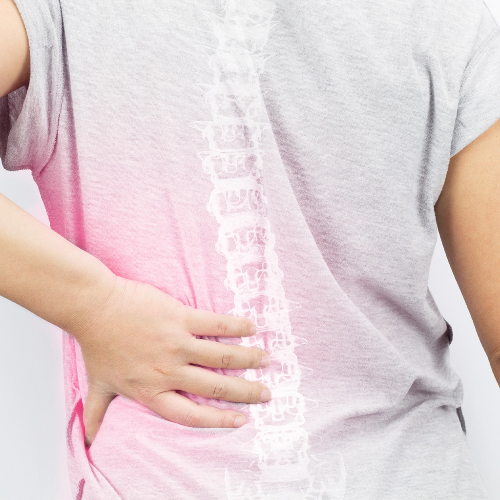 Spine Fracture Treatments
